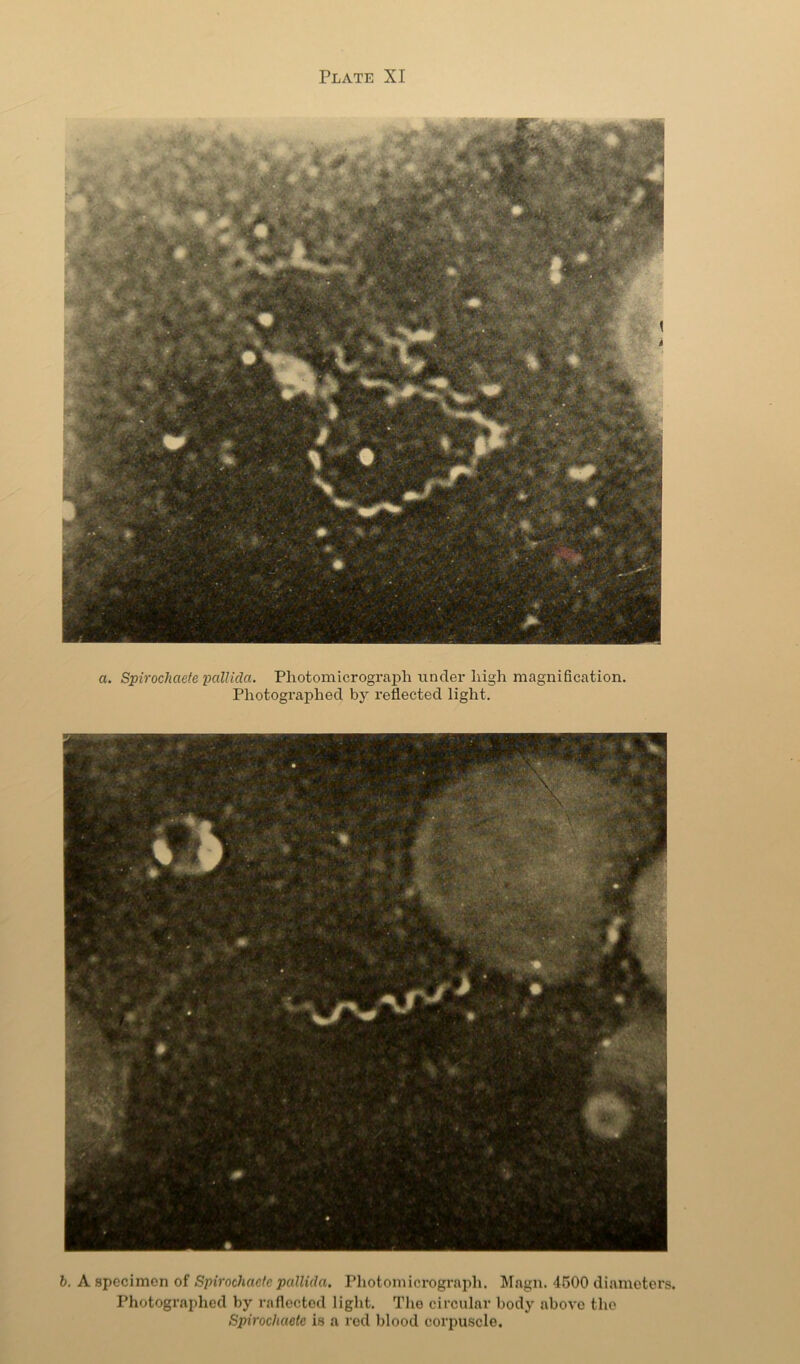 a. Spirochaefe pallida. Photomicrograph under high magnification. Photographed reflected light. h, A specimen of Spirochaelc pallida. Photomicrograph. Magn. 4500 diameters. Photographed by raflectod light. The circular body above the Spirochaelc is a rod blood coi'iniscle.