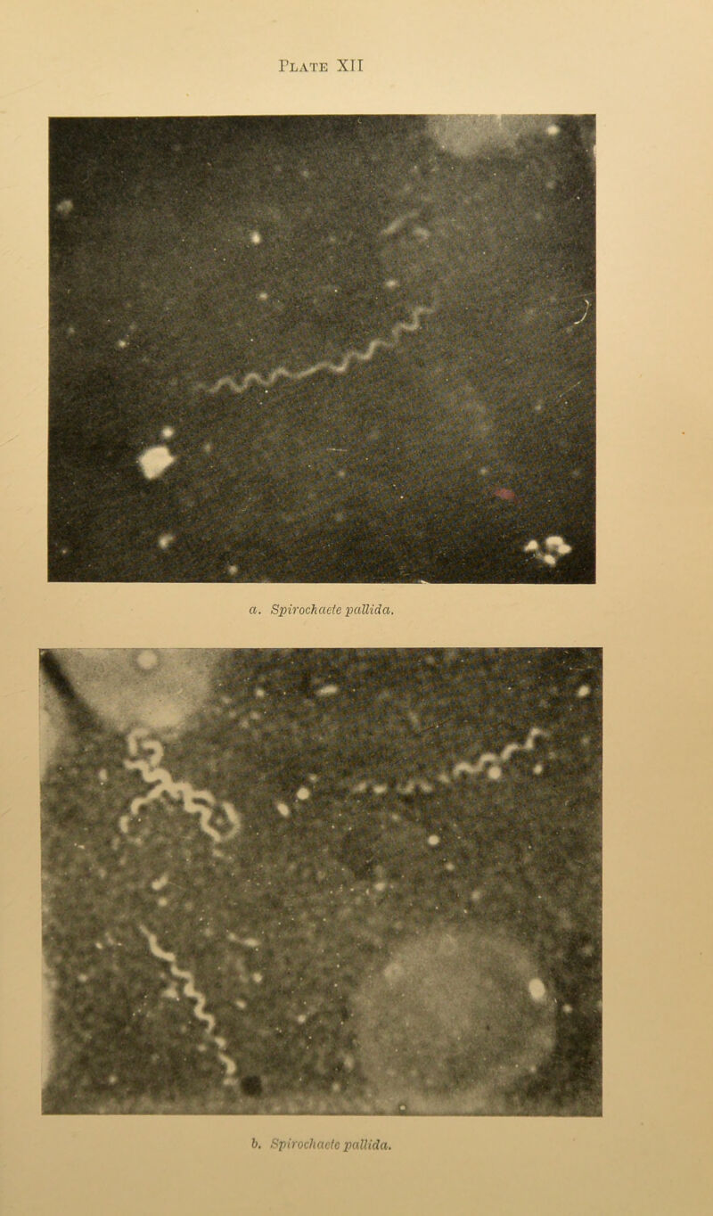 h. Spirochadc pallida.