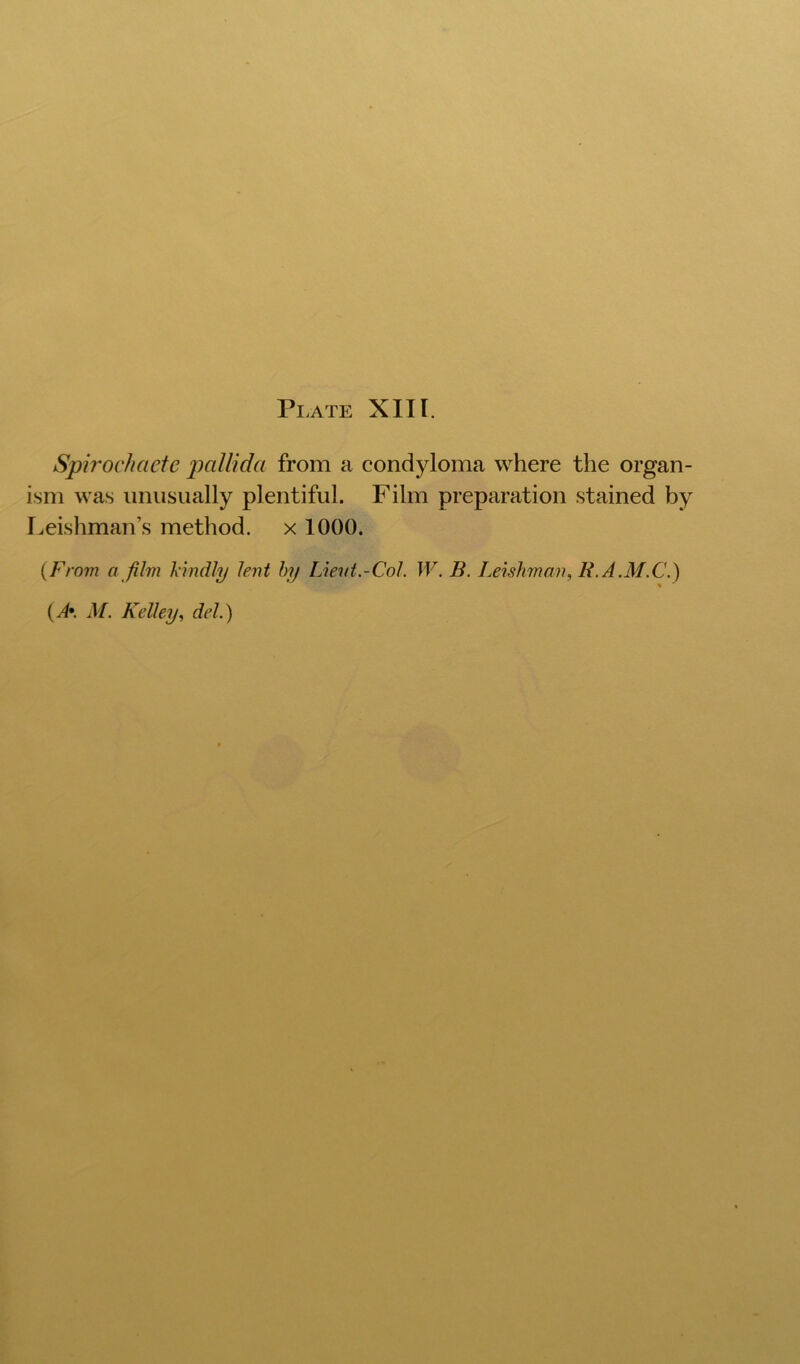 Spirochaete pallida from a condyloma where the organ- ism was imiisiially plentiful. Film preparation stained by Leishman’s method, x 1000. {From a film kindly lent hy Lient.-Col. W. B. Leishman, R.A.M.C.)