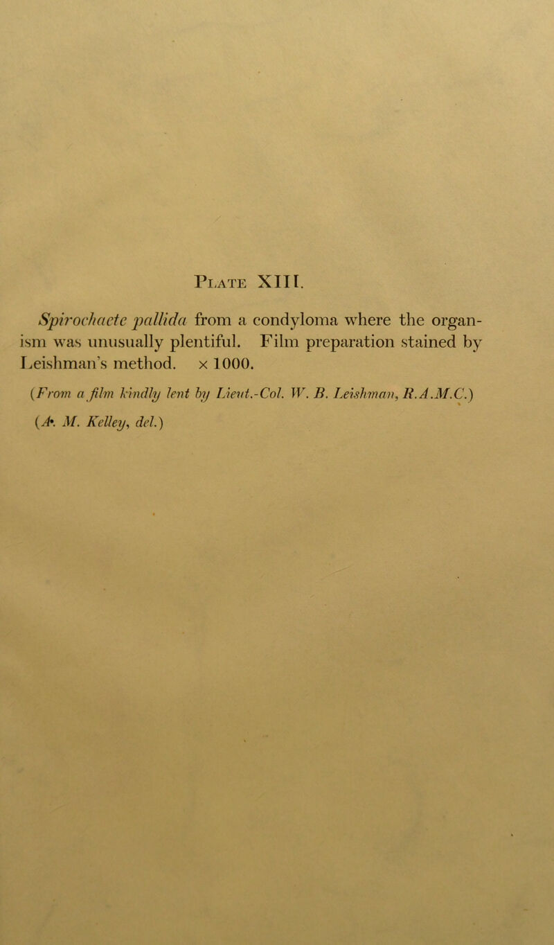 Plate XIII. Spb'ochacte pallida from a condyloma where the organ- ism was unusually plentiful. Film preparation stained by I^eishman’s method, x 1000. {From a film kindly lent hy Lient.-Col. W. B. Leishman, R.A.M.C.)