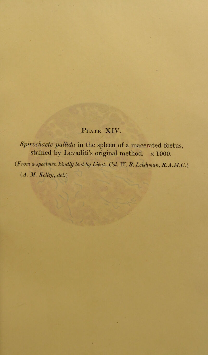 Sph'ochaete pallida in the spleen of a macerated foetus, stained by Levaditi’s original method, x 1000. {Fmm a specimen kindly lent by Lieut.-Col. W. B. Leishman, R.A.M.C.)