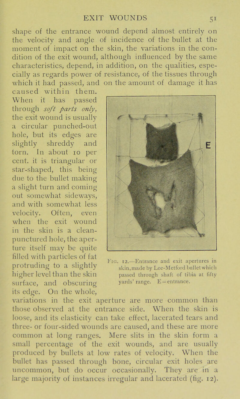 EXIT WOUNDS shape of the entrance wound depend almost entirely on the velocity and angle of incidence of the bullet at the moment of impact on the skin, the variations in the con- dition of the exit wound, although influenced by the same characteristics, depend, in addition, on the qualities, espe- cially as regards power of resistance, of the tissues through which it had passed, and on the amount of damage it has caused within them. When it has passed through soft parts only, the exit wound is usually a circular punched-out hole, but its edges are slightly shreddy and torn. In about 10 per cent, it is triangular or star-shaped, this being due to the bullet making a slight turn and coming out somewhat sideways, and with somewhat less velocity. Often, even when the exit wound in the skin is a clean- punctured hole, the aper- ture itself may be quite filled with particles of fat protruding to a slightly higher level than the skin surface, and obscuring its edge. On the whole, variations in the exit aperture are more common than those observed at the entrance side. When the skin is loose, and its elasticity can take effect, lacerated tears and three- or four-sided wounds are caused, and these are more common at long ranges. Mere slits in the skin form a small percentage of the exit wounds, and are usually produced by bullets at low rates of velocity. When the bullet has passed through bone, circular exit holes are uncommon, but do occur occasionally. They are in a large majority of instances irregular and lacerated (fig. 12). Fig. 12.—Entrance and exit apertures in skin,made by Lee-Metford liullet which passed through shaft of tibia at fifty yards’ range. E = entrance.