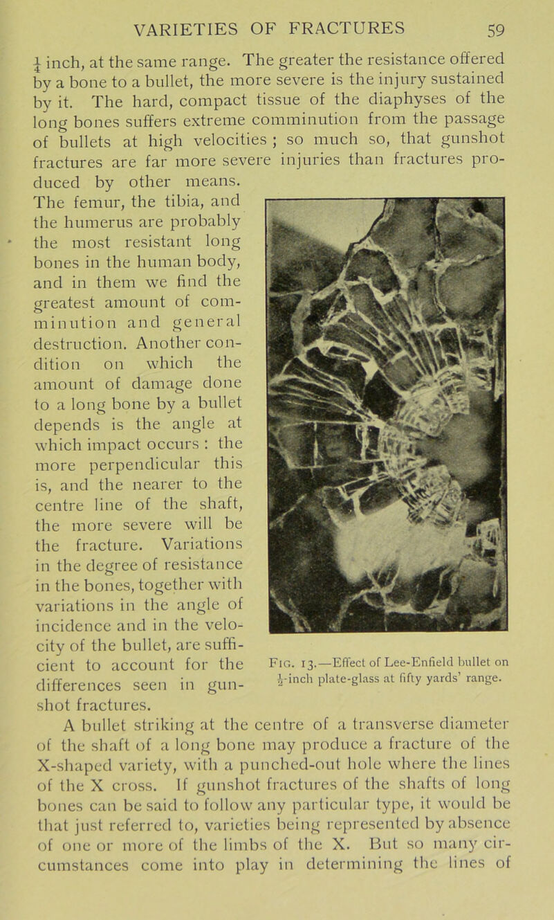 \ inch, at the same range. The greater the resistance offered by a bone to a bullet, the more severe is the injury sustained by it. The hard, compact tissue of the diaphyses of the long bones suffers extreme comminution from the passage of bullets at high velocities ; so much so, that gunshot fractures are far more severe injuries than fractures pro- duced by other means. The femur, the tibia, and the humerus are probably the most resistant long bones in the human body, and in them we find the greatest amount of com- minution and general destruction. Another con- dition on which the amount of damage done to a long bone by a bullet depends is the angle at which impact occurs : the more perpendicular this is, and the nearer to the centre line of the shaft, the more severe will be the fracture. Variations in the degree of resistance in the bones, together with variations in the angle of incidence and in the velo- city of the bullet, are suffi- cient to account for the differences seen in gun- shot fractures. A bullet striking at the centre of a transverse diameter of the shaft of a long bone may produce a fracture of the X-shaped variety, with a punched-ouf hole where the lines of the X cross. If gunshot fractures of the shafts of long bones can be said to follow any particular type, it would be that just referred to, varieties being represented by absence Fig. 13.—Effect of Lee-Enfield bullet on i-inch plate-glass at fifty yards’ range. of one or more of the limbs of the X. But so many cir- cumstances come into play in determining the lines of