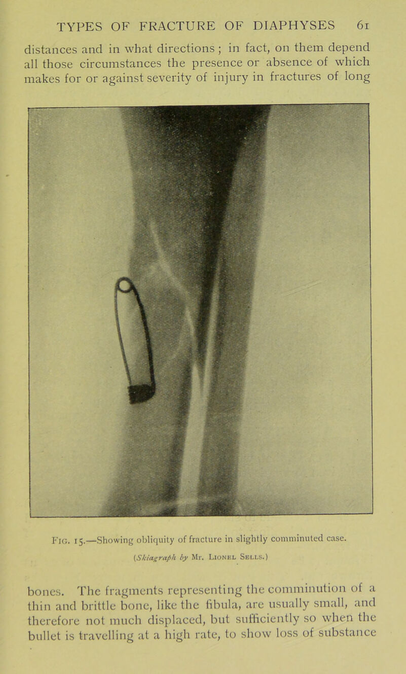 distances and in what directions ; in fact, on them depend all those circumstances the presence or absence of which makes for or against severity of injury in fractures of long Fig. 15.—Showing obliquity of fracture in slightly comminuted case. [Skiagraph by Mr. Lionel Sells.) bones. The fragments representing the comminution of a thin and brittle bone, like the hbula, are usually small, and therefore not much displaced, but sufficiently so when the bullet is travelling at a high rate, to show loss of substance