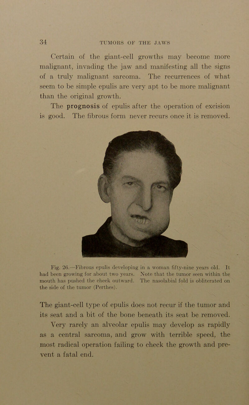 Certain of the giant-cell growths may become more malignant, invading the jaw and manifesting all the signs of a truly malignant sarcoma. The recurrences of what seem to be simple epulis are very apt to be more malignant than the original growth. The prognosis of epulis after the operation of excision is good. The fibrous form never recurs once it is removed. Fig. 26.—Fibrous epulis developing in a woman fifty-nine years old. It had been growing for about two years. Note that the tumor seen within the mouth has pushed the cheek outward. The nasolabial fold is obliterated on the side of the tumor (Perthes). The giant-cell type of epulis does not recur if the tumor and its seat and a bit of the bone beneath its seat be removed. Very rarely an alveolar epulis may develop as rapidly as a central sarcoma, and grow with terrible speed, the most radical operation failing to check the growth and pre- vent a fatal end.