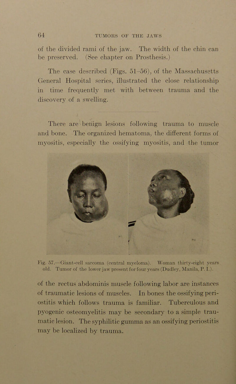 of the divided rami of the jaw. The width of the chin can be preserved. (See chapter on Prosthesis.) The case described (Figs. 51-56), of the Massachusetts General Hospital series, illustrated the close relationship in time frequently met with between trauma and the discovery of a swelling. There are benign lesions following trauma to muscle and bone. The organized hematoma, the different forms of myositis, especially the ossifying myositis, and the tumor Fig. 57.—Giant-cell sarcoma (central myeloma). Woman thirty-eight years old. Tumor of the lower jaw present for four years (Dudley, Manila, P. I.). of the rectus abdominis muscle following labor are instances of traumatic lesions of muscles. In bones the ossifying peri- ostitis which follows trauma is familiar. Tuberculous and pyogenic osteomyelitis may be secondary to a simple trau- matic lesion. The syphilitic gumma as an ossifying periostitis may be localized by trauma.
