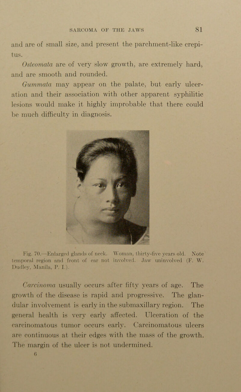 and are of small size, and present the parchment-like crepi- tus. Osteomata are of very slow growth, are extremely hard, and are smooth and rounded. Gummata may appear on the palate, but early ulcer- ation and their association with other apparent syphilitic lesions would make it highly improbable that there could be much difficulty in diagnosis. Fig. 70.—Enlarged glands of neck. Woman, thirty-five years old. Note temporal region and front of ear not involved. Jaw uninvolved (F. W. Dudley, Manila, P. I.). Carcinoma usually occurs after fifty years of age. The growth of the disease is rapid and progressive. The glan- dular involvement is early in the submaxillary region. The general health is very early affected. Ulceration of the carcinomatous tumor occurs early. Carcinomatous ulcers are continuous at their edges with the mass of the growth. The margin of the ulcer is not undermined.