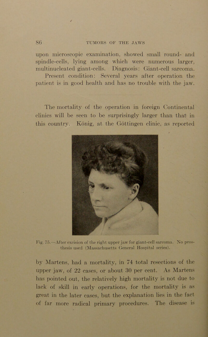 upon microscopic examination, showed small round- and spindle-cells, lying among which were numerous larger, multinucleated giant-cells. Diagnosis: Giant-cell sarcoma. Present condition: Several years after operation the patient is in good health and has no trouble with the jaw. The mortality of the operation in foreign Continental clinics will be seen to be surprisingly larger than that in this country. Konig, at the Gottingen clinic, as reported Fig. 75.—After excision of the right upper jaw for giant-cell sarcoma. No pros- thesis used (Massachusetts General Hospital series). by Martens, had a mortality, in 74 total resections of the upper jaw, of 22 cases, or about 80 per cent. As Martens has pointed out, the relatively high mortality is not due to lack of skill in early operations, for the mortality is as great in the later cases, but the explanation lies in the fact of far more radical primary procedures. The disease is