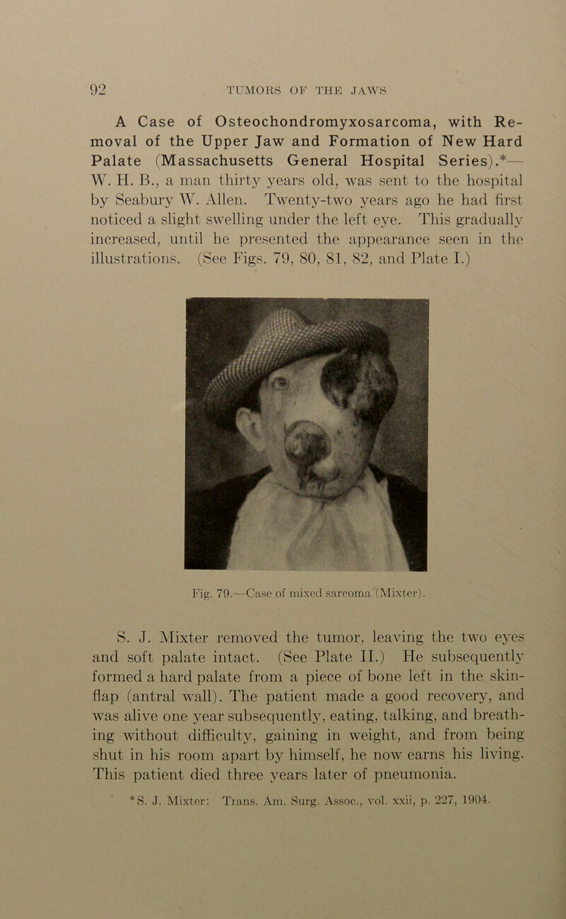 A Case of Osteochondromyxosarcoma, with Re- moval of the Upper Jaw and Formation of New Hard Palate (Massachusetts General Hospital Series).* W. H. B., a man thirty years old, was sent to the hospital by Seabury W. Allen. Twenty-two years ago he had first noticed a slight swelling under the left eye. This gradually increased, until he presented the appearance seen in the illustrations. (See Figs. 79, 80, 81, 82, and Plate I.) Fig. 79.—Case of mixed sarcoma (Mixter). S. J. Mixter removed the tumor, leaving the two eyes and soft palate intact. (See Plate II.) He subsequently formed a hard palate from a piece of bone left in the skin- flap (antral wall). The patient made a good recovery, and was alive one year subsequently, eating, talking, and breath- ing without difficulty, gaining in weight, and from being shut in his room apart by himself, he now earns his living. This patient died three years later of pneumonia. *S. J. Mixter: Trans. Am. Surg. Assoc., vol. xxii, p. 227, 1904.