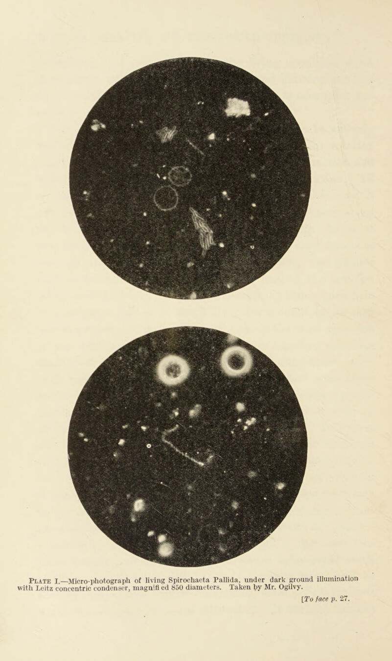 Plate I.—Micro-photograph of living Spirochacta Pallida, under dark ground illumination with Leitz concentric condenser, inagaified 850 diameters. Taken hy Mr. Ogilvy.