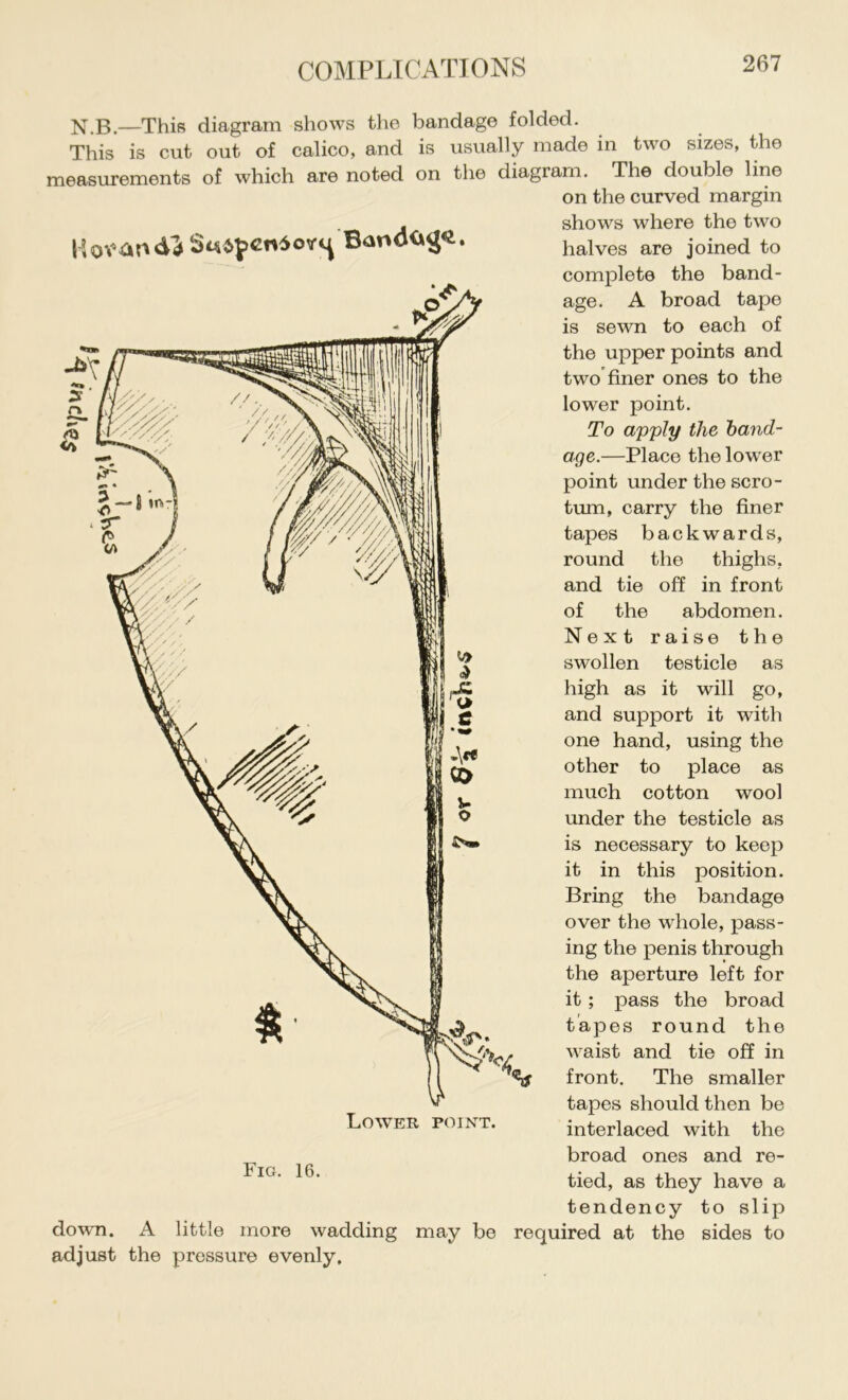 N.B.—This diagram shows the bandage folded. This is cut out of calico, and is usually made in two sizes, the measurements of which are noted on the diagram. The double line on the curved margin shows where the two halves are joined to complete the band- age. A broad tape is sewn to each of the upper points and two finer ones to the lower point. To apply the hand- age.—Place the low^er point under the scro- tum, carry the finer tapes backwards, round the thighs, and tie off in front of the abdomen. Next raise the swollen testicle as high as it will go, and support it with one hand, using the other to place as much cotton wool under the testicle as is necessary to keep it in this position. Bring the bandage over the whole, pass- ing the penis through the aperture left for it; pass the broad tapes round the waist and tie off in front. The smaller tapes should then be interlaced with the broad ones and re- tied, as they have a tendency to slip down. A little more wadding may be required at the sides to adjust the pressure evenly. Lower point. Fig. 16.