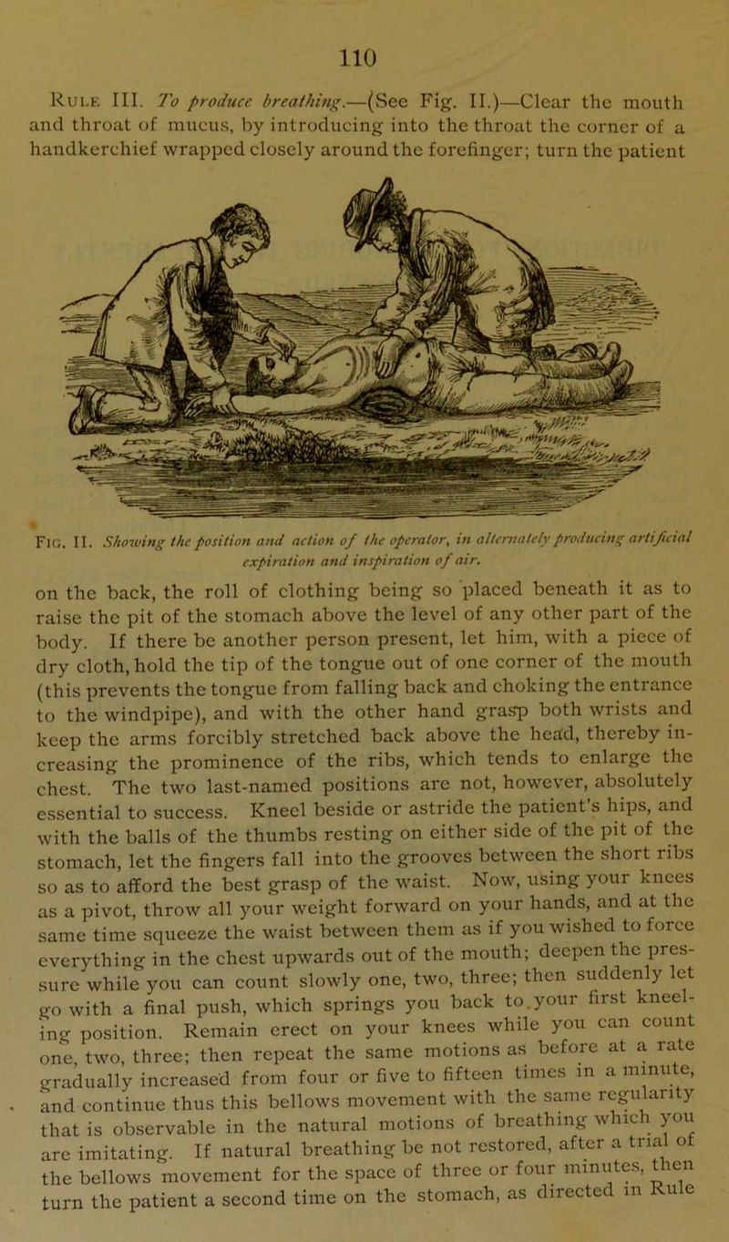 Rule III. To produce breathing.—(Sec Fig. II.)—Clear the mouth and throat of mucus, by introducing into the throat the corner of a handkerchief wrapped closely around the forefinger; turn the patient Fig. II. Showing the position and action of the operator, in alternately producing artificial expiration and inspiration of air. on the back, the roll of clothing being so placed beneath it as to raise the pit of the stomach above the level of any other part of the body. If there be another person present, let him, with a piece of dry cloth, hold the tip of the tongue out of one corner of the mouth (this prevents the tongue from falling back and choking the entrance to the windpipe), and with the other hand grasp both wrists and keep the arms forcibly stretched back above the head, thereby in- creasing the prominence of the ribs, which tends to enlarge the chest. The two last-named positions are not, however, absolutely essential to success. Kneel beside or astride the patient s hips, and with the balls of the thumbs resting on either side of the pit of the stomach, let the fingers fall into the grooves between the short ribs so as to afford the best grasp of the waist. Now, using your knees as a pivot, throw all your weight forward on your hands, and at the same time squeeze the waist between them as if you wished to force everything in the chest upwards out of the mouth; deepen the pres- sure while you can count slowly one, two, three; then suddenly let go with a final push, which springs you back to.your first kneel- ing position. Remain erect on your knees while you can count one, two, three; then repeat the same motions as before at a rate gradually increased from four or five to fifteen times in a minute, and continue thus this bellows movement with the same regularity that is observable in the natural motions of breathing which you are imitating. If natural breathing be not restored, after a trial ot the bellows movement for the space of three or four miniites, t ren turn the patient a second time on the stomach, as directe in vu e
