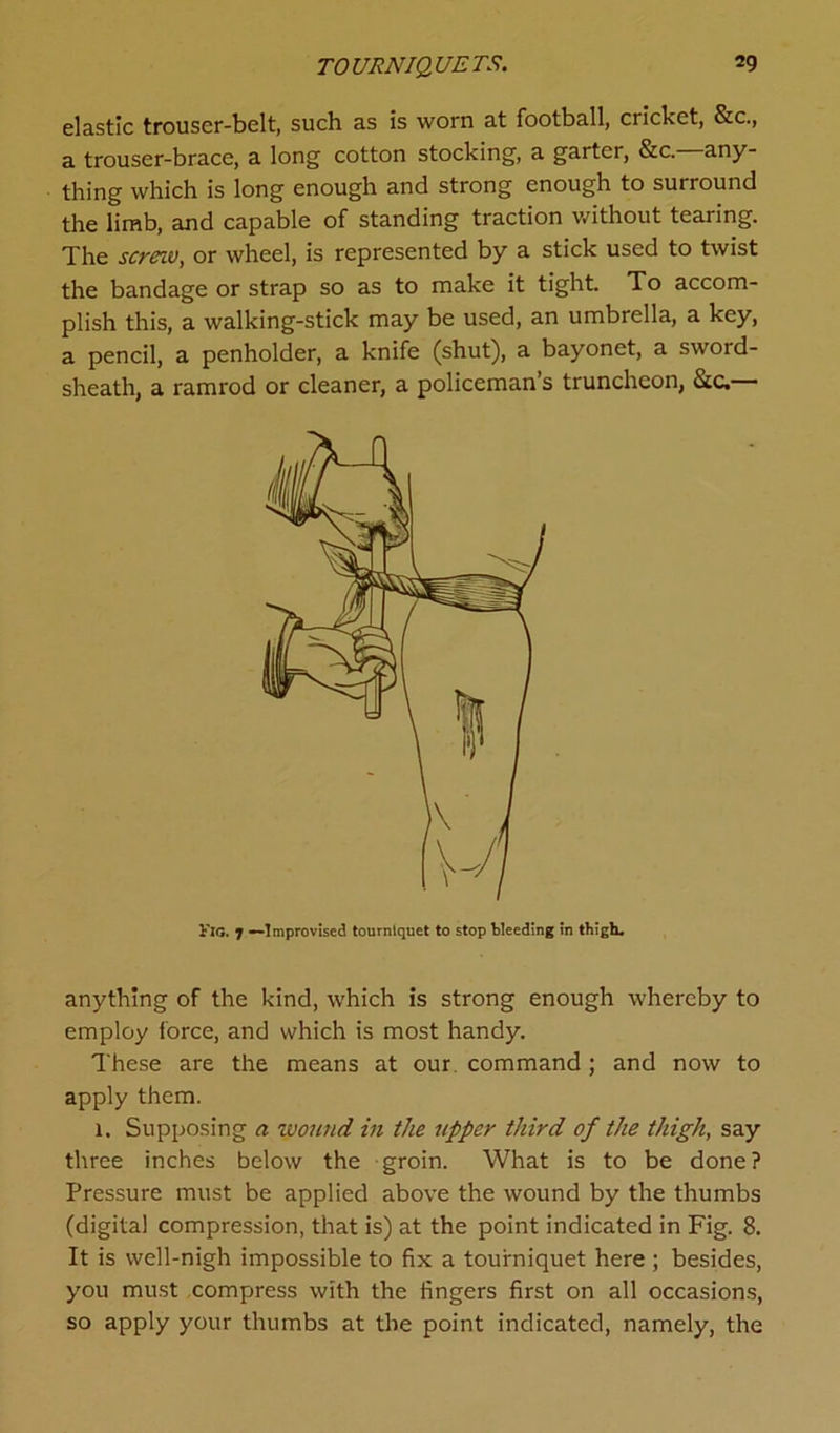 elastic trouser-belt, such as is worn at football, cricket, &c., a trouser-brace, a long cotton stocking, a garter, &c. any- thing which is long enough and strong enough to surround the limb, and capable of standing traction without tearing. The screw, or wheel, is represented by a stick used to twist the bandage or strap so as to make it tight. To accom- plish this, a walking-stick may be used, an umbrella, a key, a pencil, a penholder, a knife (shut), a bayonet, a sword- sheath, a ramrod or cleaner, a policeman’s truncheon, &c,— anything of the kind, which is strong enough whereby to employ force, and which is most handy. These are the means at our command ; and now to apply them. 1. Supposing a wound in the upper third of the thigh, say three inches below the groin. What is to be done? Pressure must be applied above the wound by the thumbs (digital compression, that is) at the point indicated in Fig. 8. It is well-nigh impossible to fix a tourniquet here ; besides, you must compress with the fingers first on all occasions, so apply your thumbs at the point indicated, namely, the Fig. 1 —Improvised tourniquet to stop Weeding in thigh.