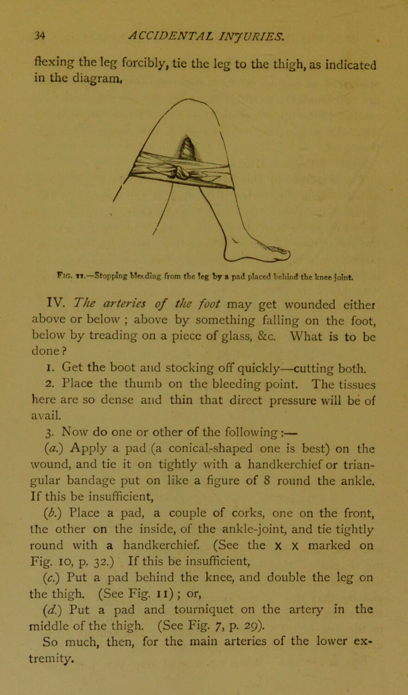 flexing the leg forcibly, tie the leg to the thigh, as indicated in the diagram, Fig. ii.—Stopping bleeding from tbe ieg by a pad placed behind the knee joint. IV. The arteries of the foot may get wounded either above or below ; above by something falling on the foot, below by treading on a piece of glass, &c. What is to be done ? 1. Get the boot and stocking off quickly—cutting both. 2. Place the thumb on the bleeding point. The tissues here are so dense and thin that direct pressure will be of avail. 3. Now do one or other of the following :— (#.) Apply a pad (a conical-shaped one is best) on the wound, and tie it on tightly with a handkerchief or trian- gular bandage put on like a figure of 8 round the ankle. If this be insufficient, ('b.) Place a pad, a couple of corks, one on the front, the other on the inside, of the ankle-joint, and tie tightly round with a handkerchief. (See the x X marked on Fig. 10, p. 32.) If this be insufficient, (c.) Put a pad behind the knee, and double the leg on the thigh. (See Fig. 11) ; or, (d.) Put a pad and tourniquet on the artery in the middle of the thigh. (See Fig. 7, p. 29). So much, then, for the main arteries of the lower ex- tremity.