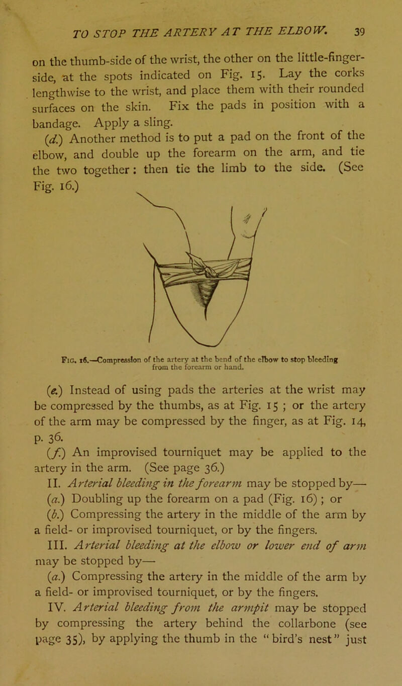 on the thumb-side of the wrist, the other on the little-finger- side, at the spots indicated on Fig. 15. Lay the corks lengthwise to the wrist, and place them with their rounded surfaces on the skin. Fix the pads in position with a bandage. Apply a sling. (,d;) Another method is to put a pad on the front of the elbow, and double up the forearm on the arm, and tie the two together: then tie the limb to the side. (See Fig. 16.) Fig. 16.—Compression of the artery at the bend of the eTbow to stop bleeding from the forearm or hand. (e.) Instead of using pads the arteries at the wrist may be compressed by the thumbs, as at Fig. 15 ; or the artery of the arm may be compressed by the finger, as at Fig. 14, p. 36. (/) An improvised tourniquet may be applied to the artery in the arm. (See page 36.) II. Arterial bleeding in the forearm may be stopped by— (a.) Doubling up the forearm on a pad (Fig. 16); or (b.) Compressing the artery in the middle of the arm by a field- or improvised tourniquet, or by the fingers. III. Arterial bleeding at the elbow or lower end of arm may be stopped by— («.) Compressing the artery in the middle of the arm by a field- or improvised tourniquet, or by the fingers. IV. Arterial bleeding from the armpit may be stopped by compressing the artery behind the collarbone (see page 35), by applying the thumb in the “bird’s nest” just