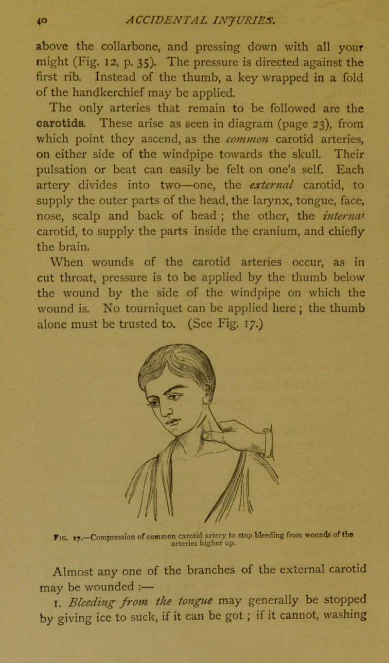 above the collarbone, and pressing down with all your might (Fig. 12, p. 35). The pressure is directed against the first rib. Instead of the thumb, a key wrapped in a fold of the handkerchief may be applied. The only arteries that remain to be followed are the carotids. These arise as seen in diagram (page 23), from which point they ascend, as the common carotid arteries, on either side of the windpipe towards the skull. Their pulsation or beat can easily be felt on one’s self. Each artery divides into two—one, the external carotid, to supply the outer parts of the head, the larynx, tongue, face, nose, scalp and back of head ; the other, the internal carotid, to supply the parts inside the cranium, and chiefly the brain. When wounds of the carotid arteries occur, as in cut throat, pressure is to be applied by the thumb below the wound by the side of the windpipe on which the wound is. No tourniquet can be applied here; the thumb alone must be trusted to. (See Fig. 17.) Fig. 17.—Compression of common carotid artery to stop bleeding from woumjs of the arteries higher up. Almost any one of the branches of the external carotid may be wounded :— 1. Bleeding from the tongue may generally be stopped by giving ice to suck, if it can be got; if it cannot, washing