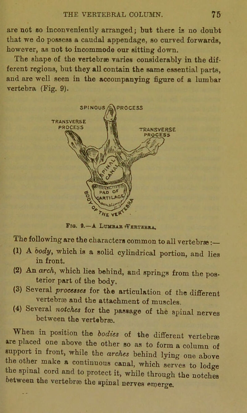 are not so inconveniently arranged; but there is no doubt that we do possess a caudal appendage, so curved forwards, however, as not to incommode our sitting down. The shape of the vertebrae varies considerably in the dif- ferent regions, but they all contain the same essential parts, and are well seen in the accompanying figure of a lumbar vertebra (Fig. 9). The following are the characters common to all vertebra*: (1) A body, which is a solid cylindrical portion, and lies in front. (2) An arch, which lies behind, and springs from the pos- terior part of the body. (3) Several processes for the articulation of the different vertebrae and the attachment of muscles. (4) Several notches for the passage of the spinal nerves between the vertebrae. When in position the bodies of the different vertebra are placed one above the other so as to form a column of support in front, while the arches behind lying one above the other make a continuous canal, which serves to lodge the spinal cord and to protect it, while through the notches between the vertobrse the spinal nerves emerge. Fio. 9.—A Lumbar •Vertxbr.a*