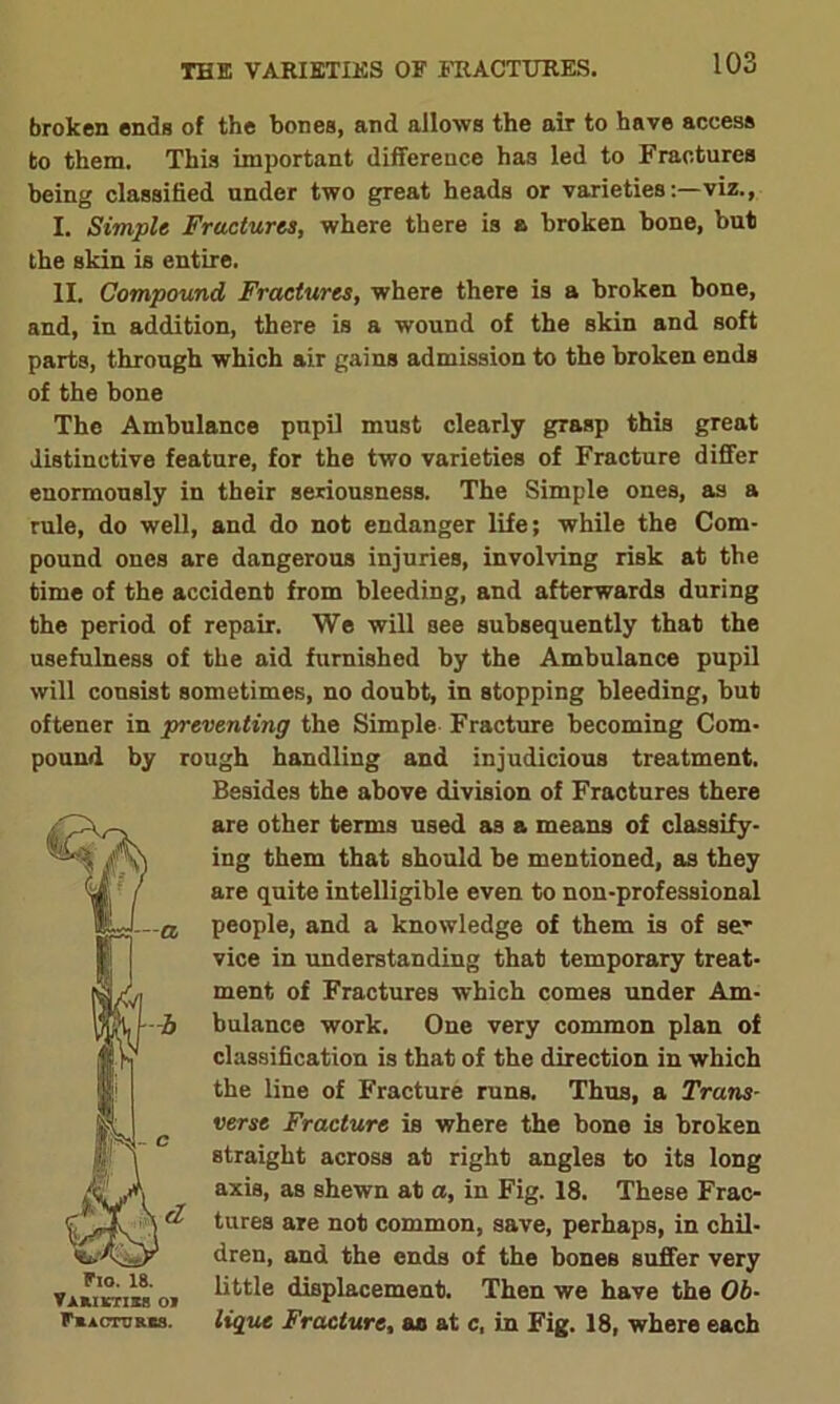 THE VARIETIES OF FRACTURES. broken ends of the bones, and allows the air to have access to them. This important difference ha3 led to Fractures being classified under two great heads or varietiesviz., I. Simple Fractures, where there is a broken bone, but the skin is entire. II. Compound Fractures, where there is a broken bone, and, in addition, there is a wound of the skin and soft parts, through which air gains admission to the broken ends of the bone The Ambulance pupil must clearly grasp this great distinctive feature, for the two varieties of Fracture differ enormously in their seriousness. The Simple ones, as a rule, do well, and do not endanger life; while the Com- pound ones are dangerous injuries, involving risk at the time of the accident from bleeding, and afterwards during the period of repair. We will see subsequently that the usefulness of the aid furnished by the Ambulance pupil will consist sometimes, no doubt, in stopping bleeding, but oftener in preventing the Simple Fracture becoming Com- pound by rough handling and injudicious treatment. Besides the above division of Fractures there are other terms used as a means of classify- ing them that should be mentioned, as they are quite intelligible even to non-professional people, and a knowledge of them is of se' vice in understanding that temporary treat- ment of Fractures which comes under Am- bulance work. One very common plan of classification is that of the direction in which the line of Fracture runs. Thus, a Trans- verse Fracture is where the bone is broken straight across at right angles to its long axis, as shewn at a, in Fig. 18. These Frac- tures are not common, save, perhaps, in chil- dren, and the ends of the bones suffer very little displacement. Then we have the Ob- lique Fracture, ae at c, in Fig. 18, where each Flo. 18. VAmirrisB oj FmACTURCS.