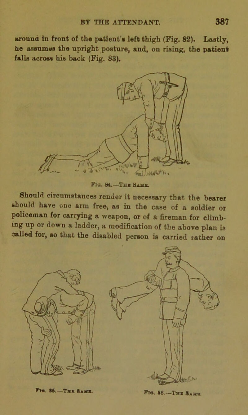 around in front of the patient's left thigh (Fig. 82). Lastly, tie assumes the upright posture, and, on rising, the patient falls across his back (Fig. 83). Should circumstances render it necessary that, the bearer should have one arm free, as in the case of a soldier or policeman for carrying a weapon, or of a fireman for climb- lng up or down a ladder, a modification of the above plan is called for, so that the disabled person is carried rather on