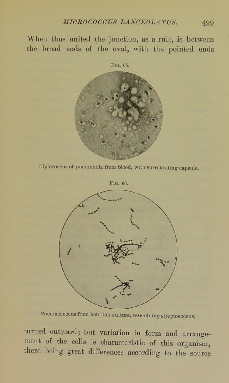 When thus united the junction, as a rule, is between the broad ends of the oval, with the pointed ends Fig. 65. Diplococcus of pneumonia from blood, with surrounding capsule. Fig. 66. Pneumococcus from bouillon culture, resembling streptococcus. turned outward; but variation in form and arrange- ment of the cells is characteristic of this organism, there being great differences according to the source