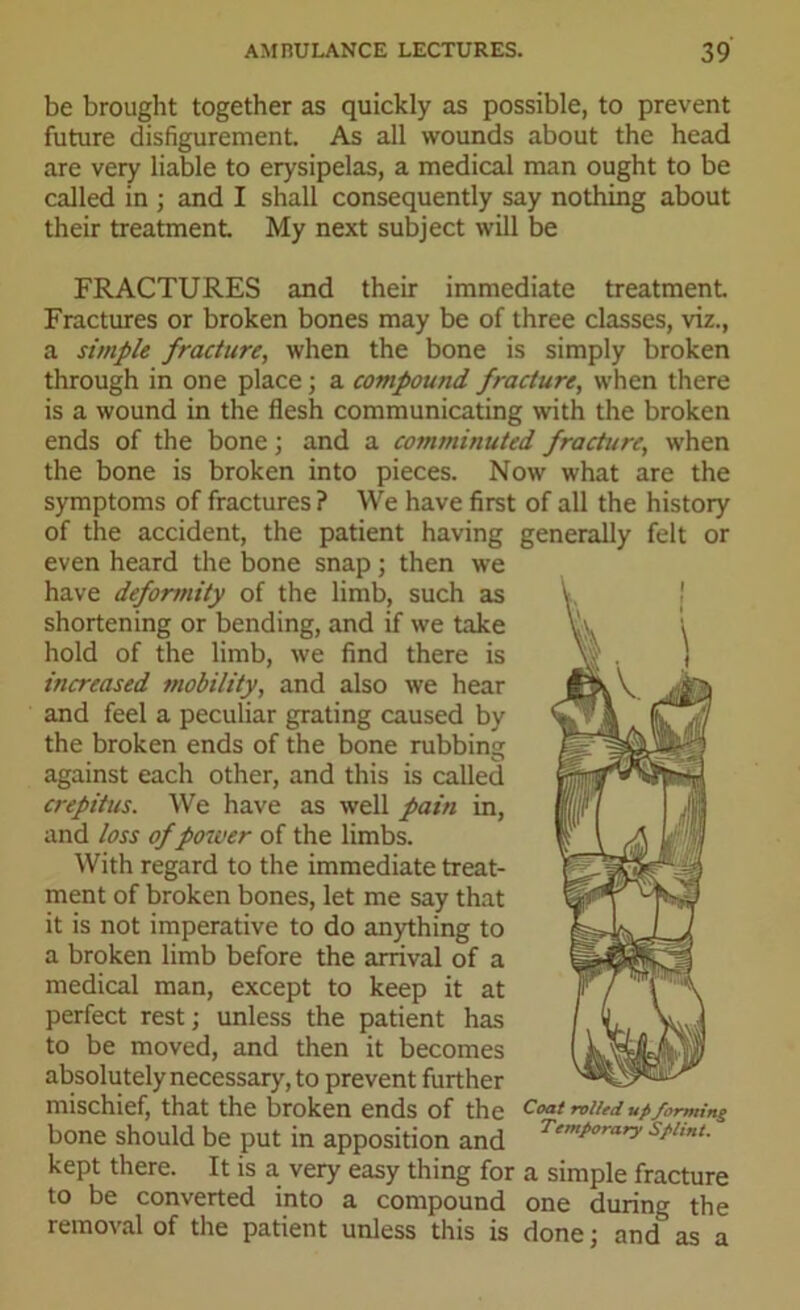 be brought together as quickly as possible, to prevent future disfigurement. As all wounds about the head are very liable to erysipelas, a medical man ought to be called in ; and I shall consequently say nothing about their treatment My next subject will be FRACTURES and their immediate treatment Fractures or broken bones may be of three classes, viz., a simple fracture, when the bone is simply broken through in one place; a compound fracture, when there is a wound in the flesh communicating with the broken ends of the bone; and a comminuted fracture, when the bone is broken into pieces. Now what are the symptoms of fractures ? We have first of all the history of the accident, the patient having generally felt or even heard the bone snap; then we have deformity of the limb, such as shortening or bending, and if we take hold of the limb, we find there is increased mobility, and also we hear and feel a peculiar grating caused by the broken ends of the bone rubbing against each other, and this is called crepitus. We have as well pain in, and loss of power of the limbs. With regard to the immediate treat- ment of broken bones, let me say that it is not imperative to do anything to a broken limb before the arrival of a medical man, except to keep it at perfect rest; unless the patient has to be moved, and then it becomes absolutely necessary, to prevent further mischief, that the broken ends of the bone should be put in apposition and kept there. It is a very easy thing for a simple fracture to be converted into a compound one during the removal of the patient unless this is done; ancf as a Coat rolled up forming Temporary Splint.