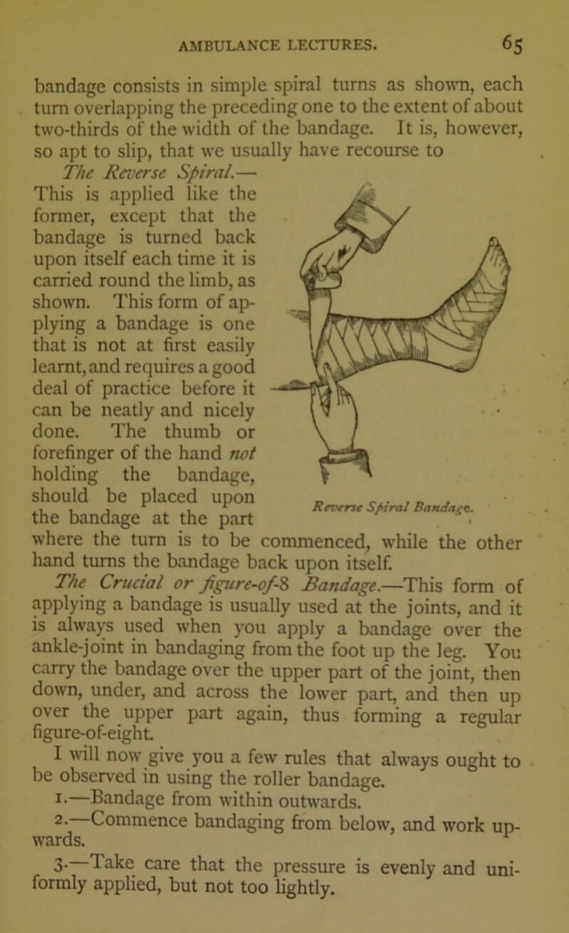 bandage consists in simple spiral turns as shown, each turn overlapping the preceding one to the extent of about two-thirds of the width of the bandage. It is, however, so apt to slip, that we usually have recourse to The Reverse Spiral.— This is applied like the former, except that the bandage is turned back upon itself each time it is carried round the limb, as shown. This form of ap- plying a bandage is one that is not at first easily learnt, and requires a good deal of practice before it can be neatly and nicely done. The thumb or forefinger of the hand not holding the bandage, should be placed upon _ , „ , the bandage at the part where the turn is to be commenced, while the other hand turns the bandage back upon itself. The Crucial or fipire-of-Z Bandage.—This form of applying a bandage is usually used at the joints, and it is always used when you apply a bandage over the ankle-joint in bandaging from the foot up the leg. You carry the bandage over the upper part of the joint, then down, under, and across the lower part, and then up over the upper part again, thus forming a regular figure-of-eight. I will now give you a few rules that always ought to be observed in using the roller bandage. 1.—Bandage from within outwards. 2- Commence bandaging from below, and work up- wards. 3- Take care that the pressure is evenly and uni- formly applied, but not too lightly.