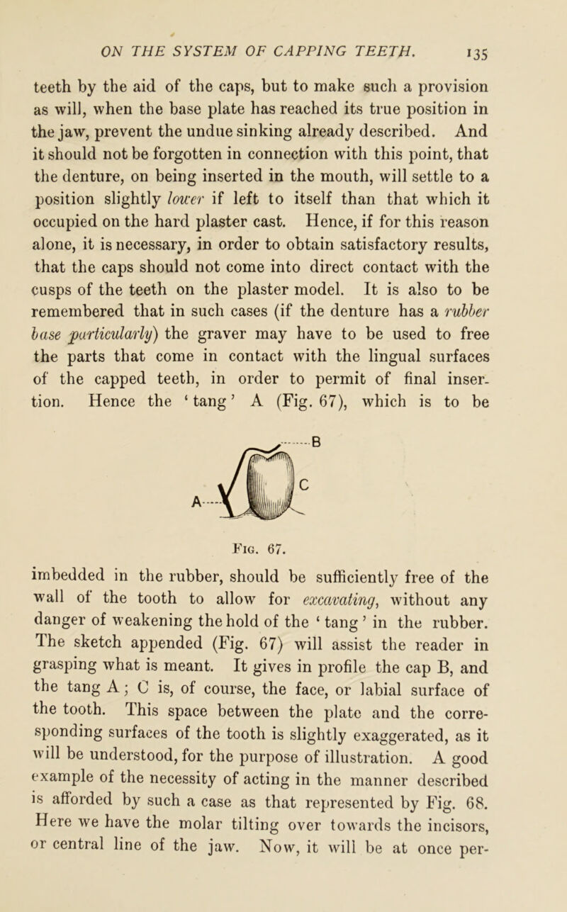 teeth by the aid of the caps, but to make such a provision as will, when the base plate has reached its true position in the jaw, prevent the undue sinking already described. And it should not be forgotten in connection with this point, that the denture, on being inserted in the mouth, will settle to a position slightly lower if left to itself than that which it occupied on the hard plaster cast. Hence, if for this reason alone, it is necessary, in order to obtain satisfactory results, that the caps should not come into direct contact with the cusps of the teeth on the plaster model. It is also to be remembered that in such cases (if the denture has a rubber base particularly) the graver may have to be used to free the parts that come in contact with the lingual surfaces of the capped teeth, in order to permit of final inser- tion. Hence the ‘tang’ A (Fig. 67), which is to be B Fig. 67. imbedded in the rubber, should be sufficiently free of the wall of the tooth to allow for excavating, without any danger of weakening the hold of the ‘ tang ’ in the rubber. Ihe sketch appended (Fig. 67) will assist the reader in grasping what is meant. It gives in profile the cap B, and the tang A; C is, of course, the face, or labial surface of the tooth. I his space between the plate and the corre- sponding surfaces of the tooth is slightly exaggerated, as it will be understood, for the purpose of illustration. A good example of the necessity of acting in the manner described is afforded by such a case as that represented by Fig. 68. Here we have the molar tilting over towards the incisors, or central line of the jaw. Now, it will be at once per-