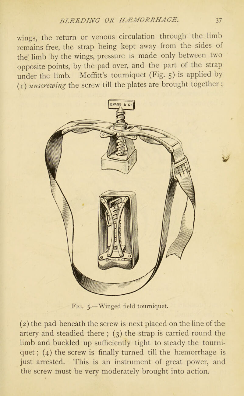 wings, the return or venous circulation through the limb remains free, the strap being kept away from the sides of the' limb by the wings, pressure is made only between two opposite points, by the pad over, and the part of the strap under the limb. Moffitt’s tourniquet (Fig. 5) is applied by (1) unscrewing the screw till the plates are brought together ; Fig. 5.— Winged field tourniquet. (2) the pad beneath the screw is next placed on the line of the artery and steadied there ; (3) the strap is carried round the limb and buckled up sufficiently tight to steady the tourni- quet ; (4) the screw is finally turned till the haemorrhage is just arrested. This is an instrument of great power, and the screw must be very moderately brought into action.