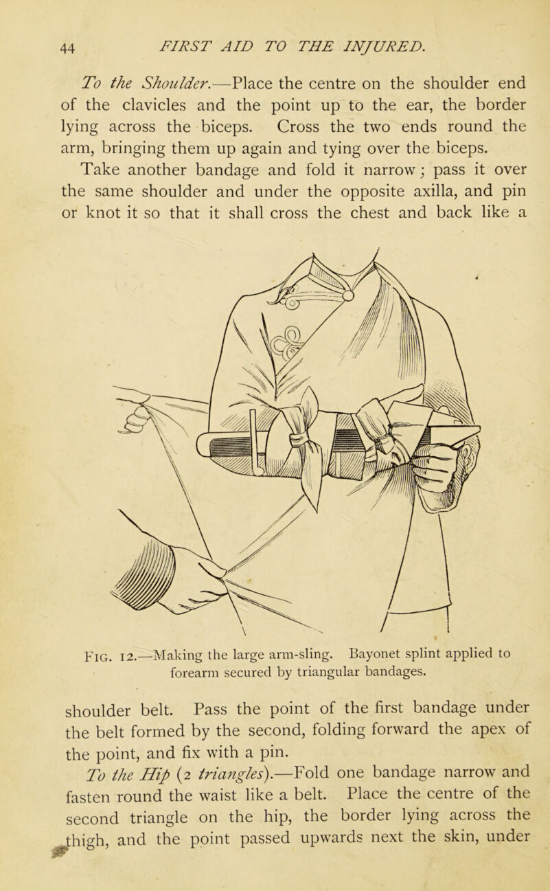 To the Shoulder.—Place the centre on the shoulder end of the clavicles and the point up to the ear, the border lying across the biceps. Cross the two ends round the arm, bringing them up again and tying over the biceps. Take another bandage and fold it narrow; pass it over the same shoulder and under the opposite axilla, and pin or knot it so that it shall cross the chest and back like a FIG. 12.—Making the large arm-sling. Bayonet splint applied to forearm secured by triangular bandages. shoulder belt. Pass the point of the first bandage under the belt formed by the second, folding forward the apex of the point, and fix with a pin. To the Hip (2 triangles).—Fold one bandage narrow and fasten round the waist like a belt. Place the centre of the second triangle on the hip, the border lying across the .thigh, and the point passed upwards next the skin, under