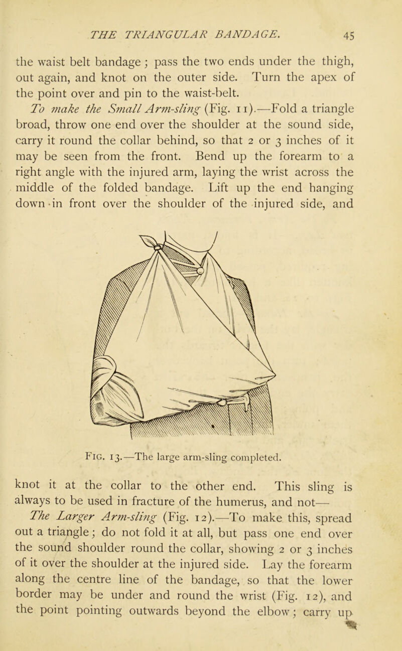 the waist belt bandage ; pass the two ends under the thigh, out again, and knot on the outer side. Turn the apex of the point over and pin to the waist-belt. To 7iiake the Small Arm-sling (Fig. n).—Fold a triangle broad, throw one end over the shoulder at the sound side, carry it round the collar behind, so that 2 or 3 inches of it may be seen from the front. Bend up the forearm to a right angle with the injured arm, laying the wrist across the middle of the folded bandage. Lift up the end hanging down-in front over the shoulder of the injured side, and Fig. 13.—The large arm-sling completed. knot it at the collar to the other end. This sling is always to be used in fracture of the humerus, and not—- The Larger Arm-sling (Fig. 12).—To make this, spread out a triangle; do not fold it at all, but pass one end over the sound shoulder round the collar, showing 2 or 3 inches of it over the shoulder at the injured side. Lay the forearm along the centre line of the bandage, so that the lower border may be under and round the wrist (Fig. 12), and the point pointing outwards beyond the elbow; carry up