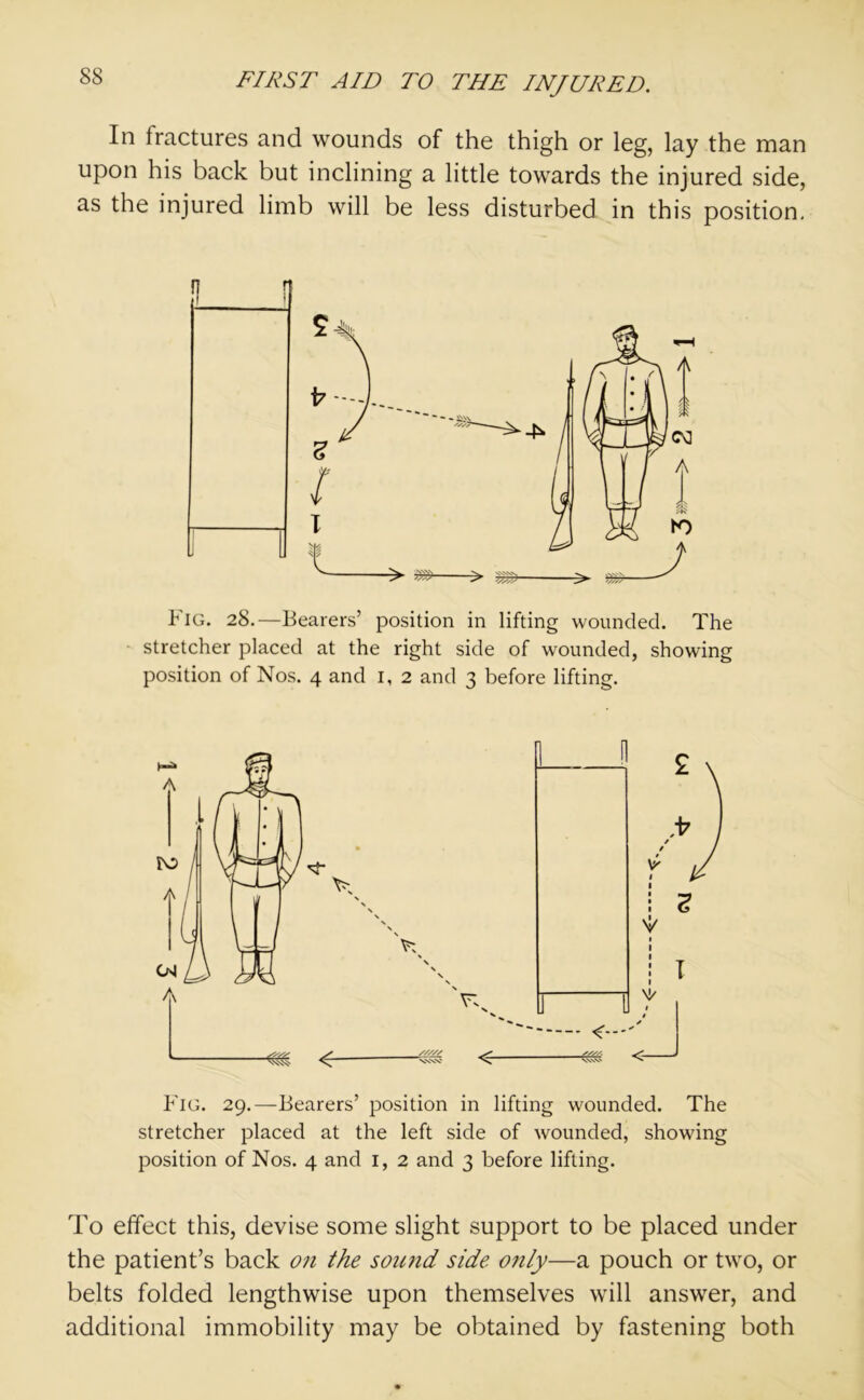 In fractures and wounds of the thigh or leg, lay the man upon his back but inclining a little towards the injured side, as the injured limb will be less disturbed in this position. Fig. 28.—Bearers’ position in lifting wounded. The stretcher placed at the right side of wounded, showing position of Nos. 4 and 1, 2 and 3 before lifting. Fig. 29.—Bearers’ position in lifting wounded. The stretcher placed at the left side of wounded, showing position of Nos. 4 and 1, 2 and 3 before lifting. To effect this, devise some slight support to be placed under the patient’s back on the sound side only—a pouch or two, or belts folded lengthwise upon themselves will answer, and additional immobility may be obtained by fastening both