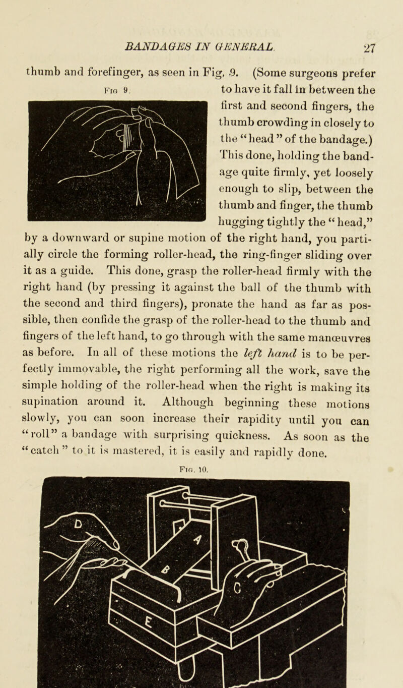 thumb and forefinger, as seen in Fig, 9. (Some surgeons prefer first and second fingers, the thumb crowding in closely to This done, holding the band- age quite firmly, yet loosely enough to slip, between the thumb and finger, the thumb hugging tightly the “ head,” by a downward or supine motion of the right hand, you parti- ally circle the forming roller-head, the ring-finger sliding over it as a guide. This done, grasp the roller-head firmly with the right hand (by pressing it against the ball of the thumb with the second and third fingers), pronate the hand as far as pos- sible, then confide the grasp of the roller-head to the thumb and fingers of the left hand, to go through with the same manoeuvres as before. In all of these motions the left hand is to be per- fectly immovable, the right performing all the work, save the simple holding of the roller-head when the right is making its supination around it. Although beginning these motions slowly, you can soon increase their rapidity until you can “roll” a bandage with surprising quickness. As soon as the “catch” to it is mastered, it is easily and rapidly done.