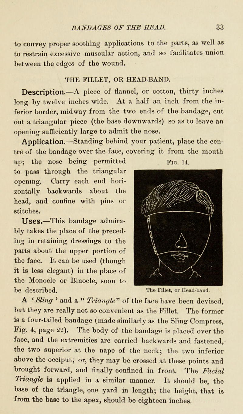to convey proper soothing applications to the parts, as well as to restrain excessive muscular action, and so facilitates union between the edges of the wound. THE FILLET, OR HEAD-BAND. Description.—A piece of flannel, or cotton, thirty inches long by twelve inches wide. At a half an inch from the in- ferior border, midway from the two ends of the bandage, cut out a triangular piece (the base downwards) so as to leave an opening sufficiently large to admit the nose. Application.—Standing behind your patient, place the cen- tre of the bandage over the face, covering it from the mouth up-, the nose being permitted to pass through the triangular opening. Carry each end hori- zontally backwards about the head, and confine with pins or stitches. Uses.—This bandage admira- bly takes the place of the preced- ing in retaining dressings to the parts about the upper portion of the face. It can be used (though it is less elegant) in the place of the Monocle or Binocle, soon to be described. A ‘ Sling ’ and a “ Triangle” of the face have been devised, but they are really not so convenient as the Fillet. The former is a four-tailed bandage (made similarly as the Sling Compress, Fig. 4, page 22), The body of the bandage is placed over the face, and the extremities are carried backwards and fastened,* the two superior at the nape of the neck; the two inferior above the occiput; or, they may be crossed at these points and brought forward, and finally confined in front. The Facial Triangle is applied in a similar manner. It should be, the base of the triangle, one yard in length; the height, that is from the base to the apex, should be eighteen inches, Fig. 14. The Fillet, or Head-band.