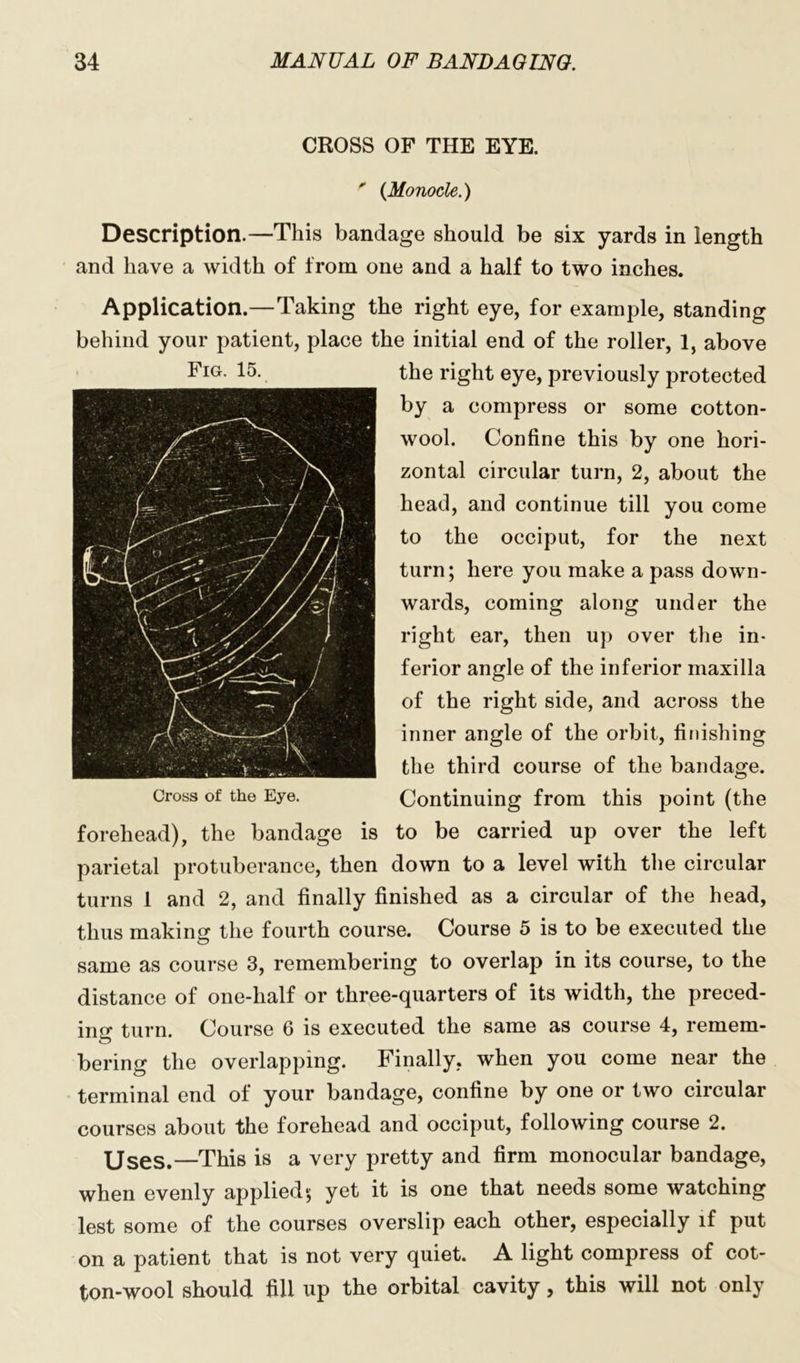 CROSS OF THE EYE. ' {Monocle.) Description.—This bandage should be six yards in length and have a width of from one and a half to two inches. Application.—Taking the right eye, for example, standing behind your patient, place the initial end of the roller, 1, above the right eye, previously protected by a compress or some cotton- wool. Confine this by one hori- zontal circular turn, 2, about the head, and continue till you come to the occiput, for the next turn; here you make a pass down- wards, coming along under the right ear, then up over the in- ferior angle of the inferior maxilla of the right side, and across the inner angle of the orbit, finishing the third course of the bandage. Continuing from this point (the forehead), the bandage is to be carried up over the left parietal protuberance, then down to a level with the circular turns 1 and 2, and finally finished as a circular of the head, thus making the fourth course. Course 5 is to be executed the same as course 3, remembering to overlap in its course, to the distance of one-half or three-quarters of its width, the preced- ing turn. Course 6 is executed the same as course 4, remem- bering the overlapping. Finally, when you come near the terminal end of your bandage, confine by one or two circular courses about the forehead and occiput, following course 2. Uses.—This is a very pretty and firm monocular bandage, when evenly applied; yet it is one that needs some watching lest some of the courses overslip each other, especially if put on a patient that is not very quiet. A light compress of cot- ton-wool should fill up the orbital cavity, this will not only