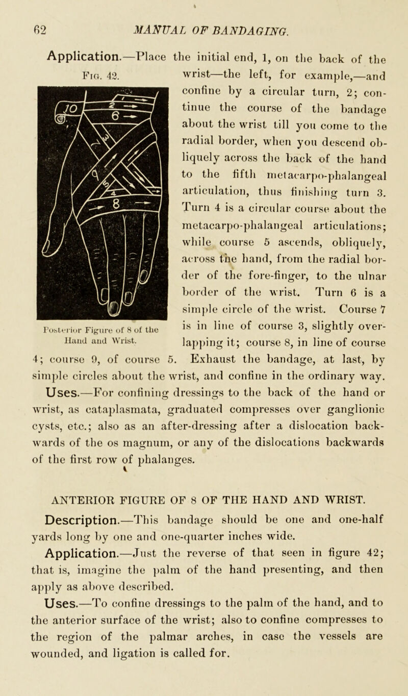 Application.—Place the initial end, 1, on the back of the Fig. 42. wrist—the left, for example,—and confine by a circular turn, 2; con- tinue the course of the bandage about the wrist till you come to the radial border, when you descend ob- liquely across the back of the hand to the fifth metacarpo-phalangeal articulation, thus finishing turn 3. Turn 4 is a circular course about the metacarpo-phalangeal articulations; while course 5 ascends, obliquely, across the hand, from the radial bol - der of the fore-finger, to the ulnar border of the wrist. Turn 6 is a simple circle of the wrist. Course 7 is in line of course 3, slightly over- lapping it; course 8, in line of course 4; course 9, of course 5. Exhaust the bandage, at last, by simple circles about the wrist, and confine in the ordinary way. Uses.—For confining dressings to the back of the hand or wrist, as cataplasmata, graduated compresses over ganglionic cysts, etc.; also as an after-dressing after a dislocation back- wards of the os magnum, or any of the dislocations backwards of the first row of phalanges. Posterior Figure of 8 of the If and and Wrist. ANTERIOR FIGURE OF 8 OF THE HAND AND WRIST. Description.—This bandage should be one and one-half yards long by one and one-quarter inches wide. Application.—Just the reverse of that seen in figure 42; that is, imagine the palm of the hand presenting, and then apply as above described. Uses.—To confine dressings to the palm of the hand, and to the anterior surface of the wrist; also to confine compresses to the region of the palmar arches, in case the vessels are wounded, and ligation is called for.