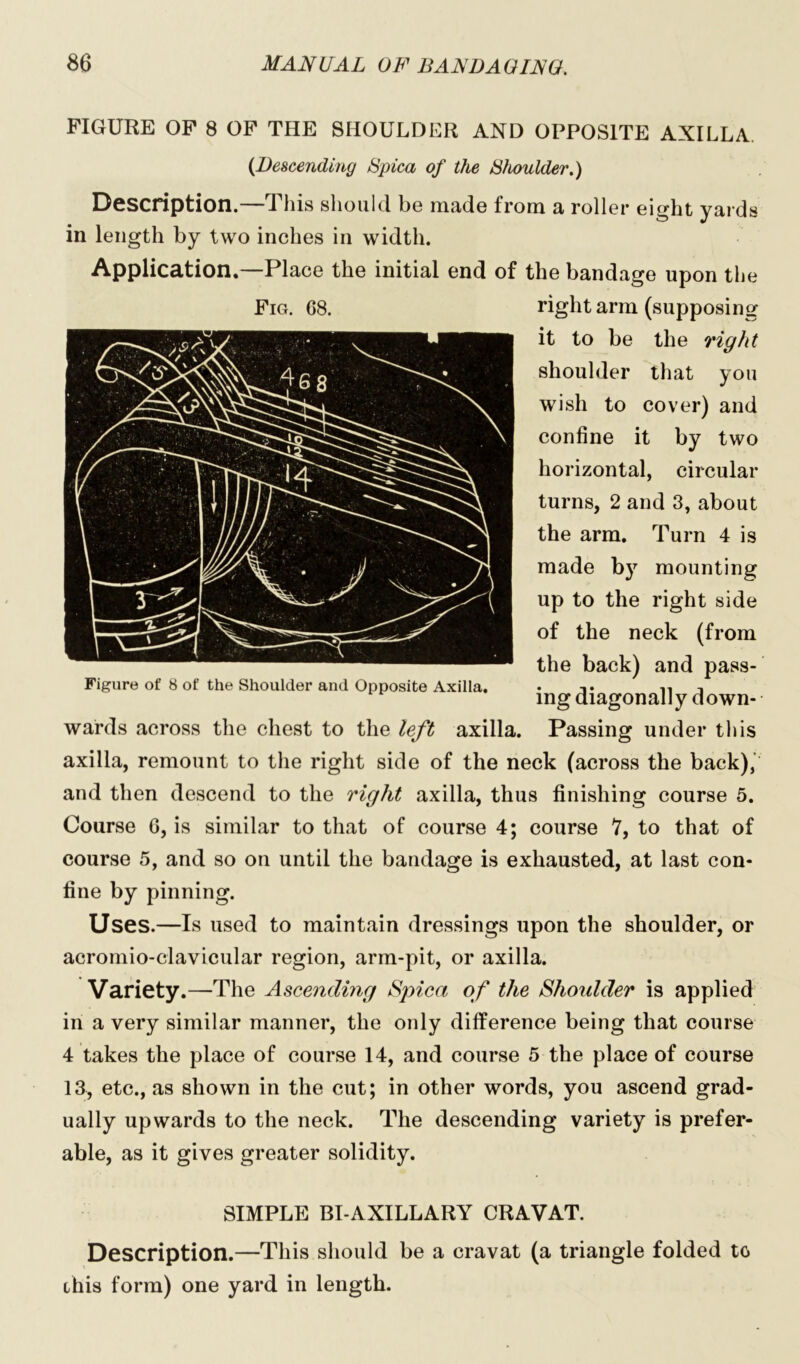 FIGURE OF 8 OF THE SHOULDER AND OPPOSITE AXILLA (Descending Spica of the Shoulder.) Description.—This should be made from a roller eight yards in length by two inches in width. Application.—Place the initial end of the bandage upon the right arm (supposing it to be the right shoulder that you wish to cover) and confine it by two horizontal, circular turns, 2 and 3, about the arm. Turn 4 is made by mounting up to the right side of the neck (from the back) and pass- ing diagonally down- wards across the chest to the left axilla. Passing under this axilla, remount to the right side of the neck (across the back), and then descend to the right axilla, thus finishing course 5. Course G, is similar to that of course 4; course V, to that of course 5, and so on until the bandage is exhausted, at last con- fine by pinning. Uses.—Is used to maintain dressings upon the shoulder, or acromio-clavicular region, arm-pit, or axilla. Variety.—The Ascending Spica of the Shoidder is applied in a very similar manner, the only difference being that course 4 takes the place of course 14, and course 5 the place of course 13, etc., as shown in the cut; in other words, you ascend grad- ually upwards to the neck. The descending variety is prefer- able, as it gives greater solidity. SIMPLE BI-AXILLARY CRAVAT. Description.—This should be a cravat (a triangle folded to this form) one yard in length. Fig. 68. Figure of 8 of the Shoulder and Opposite Axilla.