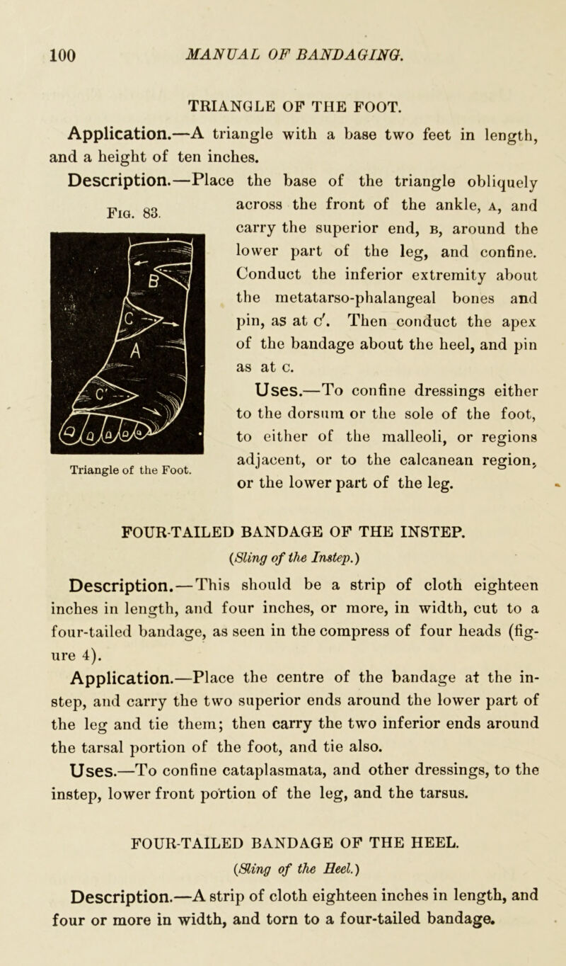 TRIANGLE OF THE FOOT. Application.—A triangle with a base two feet in length, and a height of ten inches. Description.—Place the base of the triangle obliquely across the front of the ankle, a, and carry the superior end, b, around the lower part of the leg, and confine. Conduct the inferior extremity about the metatarso-phalangeal bones and pin, as at c\ Then conduct the apex of the bandage about the heel, and pin as at c. Uses.—To confine dressings either to the dorsum or the sole of the foot, to either of the malleoli, or regions adjacent, or to the calcanean region, or the lower part of the leg. FOUR-TAILED BANDAGE OF THE INSTEP. (Sling of the Instep.) Description. — This should be a strip of cloth eighteen inches in length, and four inches, or more, in width, cut to a four-tailed bandage, as seen in the compress of four heads (fig- ure 4). Application.—Place the centre of the bandage at the in- step, and carry the two superior ends around the lower part of the leg and tie them; then carry the two inferior ends around the tarsal portion of the foot, and tie also. Uses.—To confine cataplasmata, and other dressings, to the instep, lower front portion of the leg, and the tarsus. FOUR-TAILED BANDAGE OF THE HEEL. (Sling of the Heel.) Description.—A strip of cloth eighteen inches in length, and four or more in width, and torn to a four-tailed bandage. Fig. 83. Triangle of the Foot.