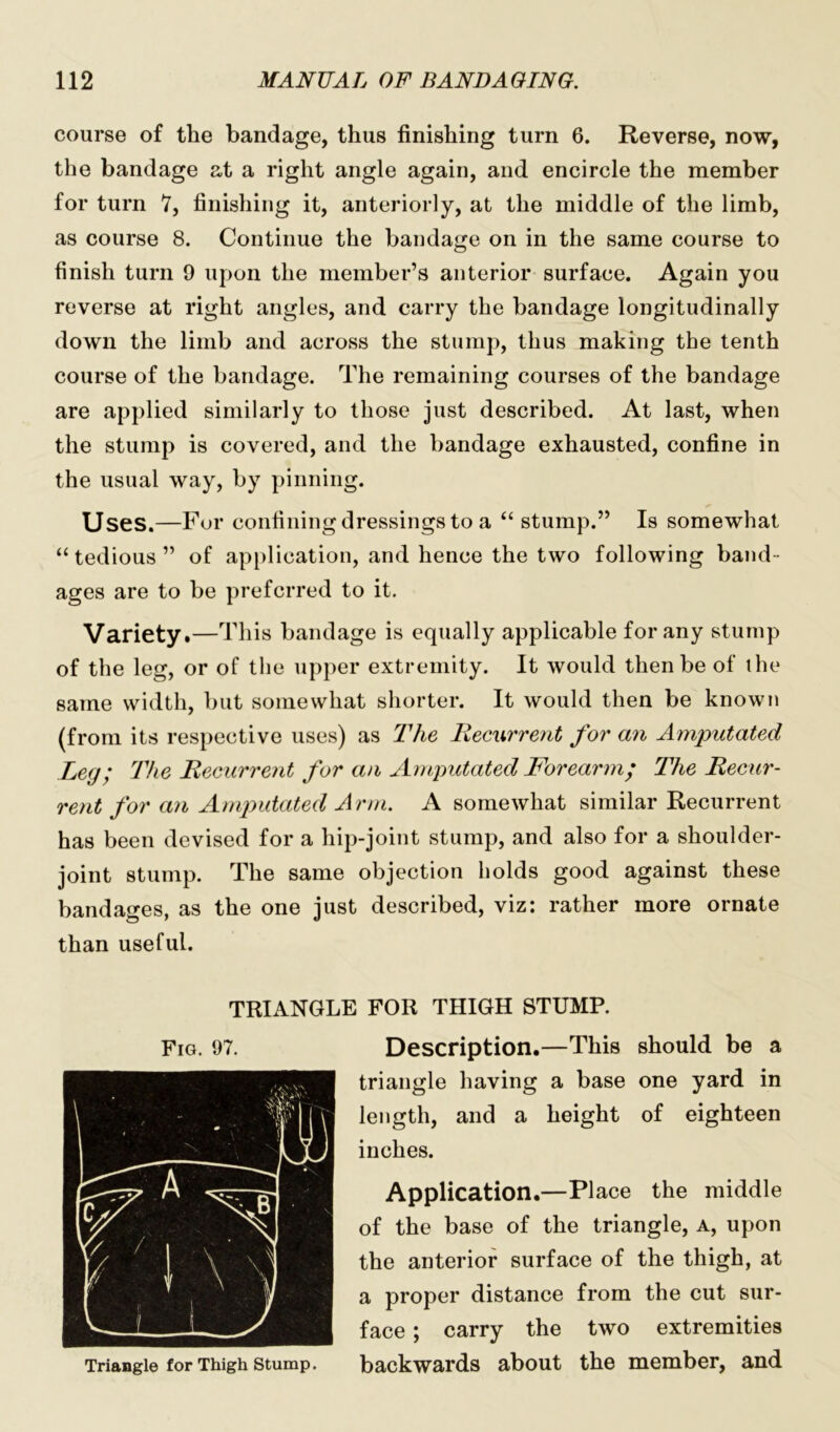 course of the bandage, thus finishing turn 6. Reverse, now, the bandage at a right angle again, and encircle the member for turn 7, finishing it, anteriorly, at the middle of the limb, as course 8. Continue the bandage on in the same course to finish turn 9 upon the member’s anterior surface. Again you reverse at right angles, and carry the bandage longitudinally down the limb and across the stump, thus making the tenth course of the bandage. The remaining courses of the bandage are applied similarly to those just described. At last, when the stump is covered, and the bandage exhausted, confine in the usual way, by pinning. Uses.—For confining dressings to a “ stump.” Is somewhat “tedious” of application, and hence the two following band- ages are to be preferred to it. Variety.—This bandage is equally applicable for any stump of the leg, or of the upper extremity. It would then be of the same width, but somewhat shorter. It would then be known (from its respective uses) as The Recurrent for an Amputated Leg; The Recurrent for an Amputated Forearm; The Recur- rent for an Amputated Arm. A somewhat similar Recurrent has been devised for a hip-joint stump, and also for a shoulder- joint stump. The same objection holds good against these bandages, as the one just described, viz: rather more ornate than useful. TRIANGLE FOR THIGH STUMP. Fig. 97. Triangle for Thigh Stump. Description.—This should be a triangle having a base one yard in length, and a height of eighteen inches. Application.—Place the middle of the base of the triangle, a, upon the anterior surface of the thigh, at a proper distance from the cut sur- face ; carry the two extremities backwards about the member, and