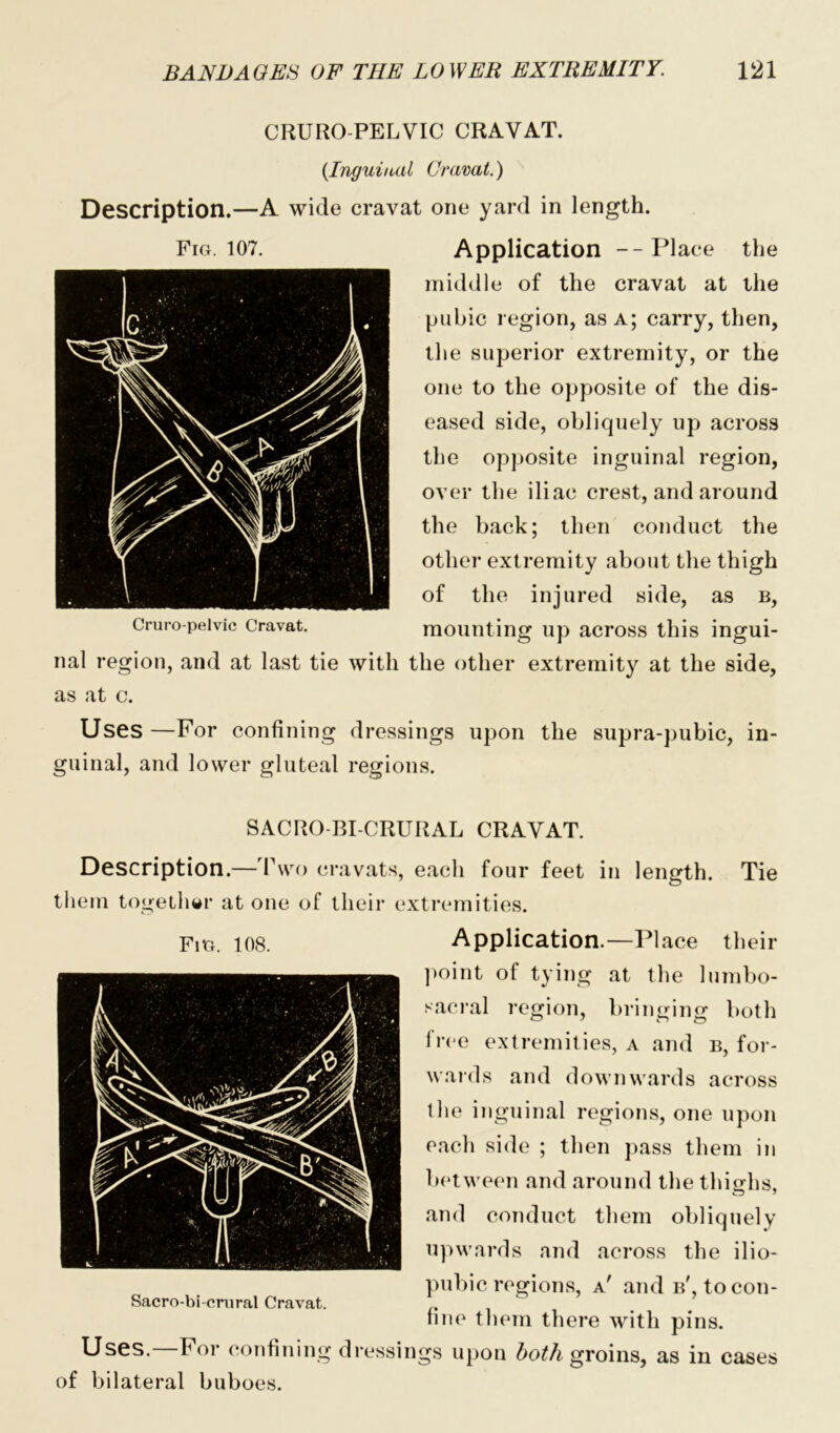 CRURO-PELVIC CRAVAT. {Inguinal Or amt.) Description.—A wide cravat one yard in length. Application --Place the middle of the cravat at the pubic region, as a; carry, then, the superior extremity, or the one to the opposite of the dis- eased side, obliquely up across the opposite inguinal region, over the iliac crest, and around the back; then conduct the other extremity about the thigh of the injured side, as b, mounting up across this ingui- nal region, and at last tie with the other extremity at the side, as at c. Uses —For confining dressings upon the supra-pubic, in- guinal, and lower gluteal regions. SACRO BI-CRURAL CRAVAT. Description.—-Two cravats, each four feet in length. Tie them together at one of their extremities. Application.—Place their point of tying at the lumbo- sacral region, bringing both free extremities, a and b, for- wards and downwards across the inguinal regions, one upon each side ; then pass them in between and around the thighs, and conduct them obliquely upwards and across the ilio- pubic regions, a' and b', to con- fine them there with pins. Uses.—For confining dressings upon both groins, as in cases of bilateral buboes. Fig. 107.