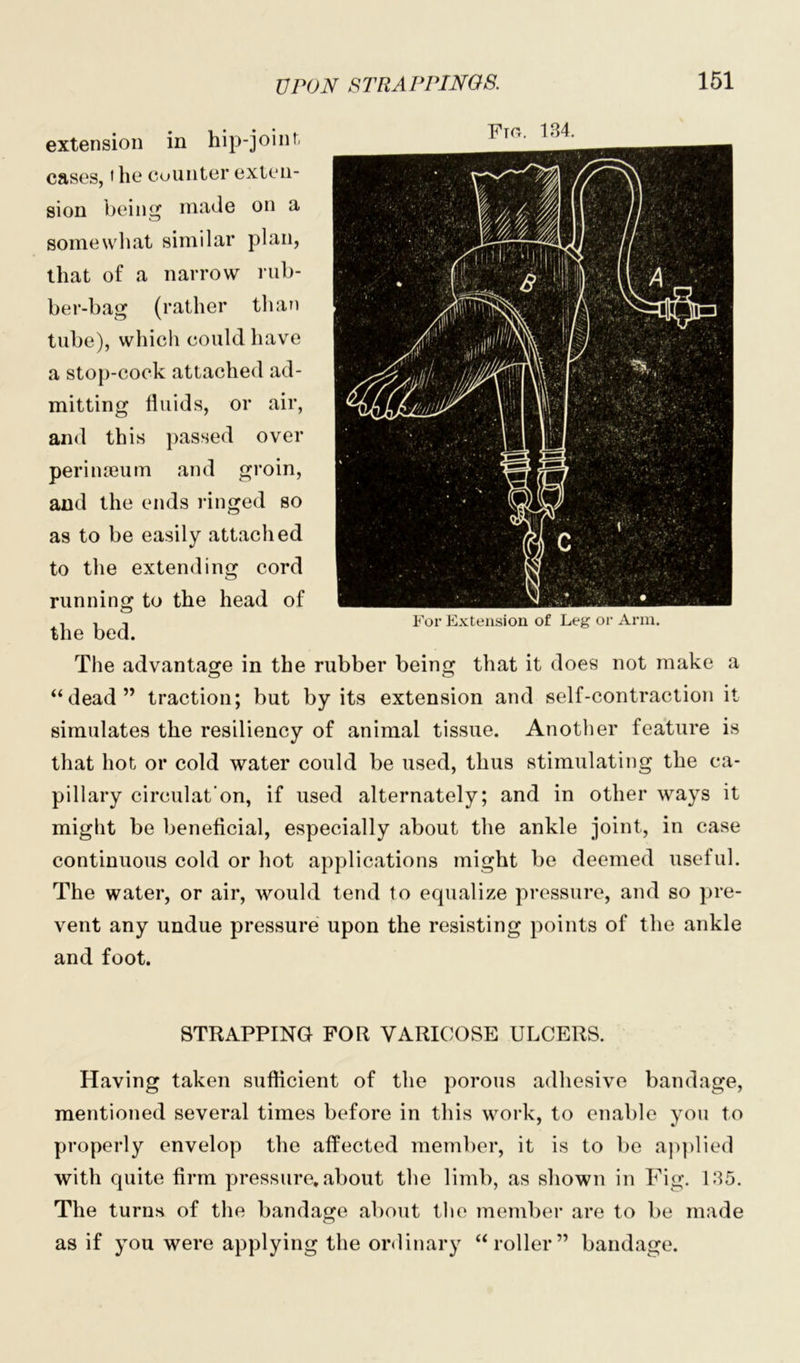 extension in hip-joint 1 cases, i he counter exten- sion being made on a somewhat similar plan, that of a narrow rub- ber-bag (rather than tube), which could have a stop-cock attached ad- mitting fluids, or air, and this passed over perinaeum and groin, and the ends ringed so as to be easily attached to the extending cord running to the head of the bed. The advantage in the rubber being that it does not make a “dead” traction; but by its extension and self-contraction it simulates the resiliency of animal tissue. Another feature is that hot or cold water could be used, thus stimulating the ca- pillary circulat’on, if used alternately; and in other ways it might be beneficial, especially about the ankle joint, in case continuous cold or hot applications might be deemed useful. The water, or air, would tend to equalize pressure, and so pre- vent any undue pressure upon the resisting points of the ankle and foot. For Extension of Leg or Arm. STRAPPING FOR VARICOSE ULCERS. Having taken sufficient of the porous adhesive bandage, mentioned several times before in this work, to enable you to properly envelop the affected member, it is to be applied with quite firm pressure.about the limb, as shown in Fig. LI5. The turns of the bandage about the member are to be made as if you were applying the ordinary “roller” bandage.