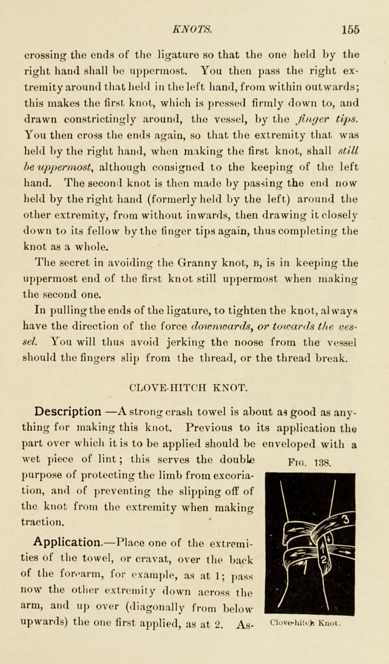 crossing the ends of the ligature so that the one held by the right hand shall be uppermost. You then pass the right ex- tremity around that held in the left hand, from within outwards; this makes the first knot, which is pressed firmly down to, and drawn constrictingly around, the vessel, by the finger tips. You then cross the ends again, so that the extremity that was held by the right hand, when making the first knot, shall still be uppermost, although consigned to the keeping of the left hand. The second knot is then made by passing the end now held by the right hand (formerly held by the left) around the other extremity, from without inwards, then drawing it closely down to its fellow by the finger tips again, thus completing the knot as a whole. The secret in avoiding the Granny knot, b, is in keeping the uppermost end of the first knot still uppermost when making the second one. In pulling the ends of the ligature, to tighten the knot, al ways have the direction of the force downwards, or towards the ves- sel. You will thus avoid jerking the noose from the vessel should the fingers slip from the thread, or the thread break. CLOVE-HITCH KNOT. Description —A strong crash towel is about as good as any- thing for making this knot. Previous to its application the part over which it is to be applied should be enveloped with a wet piece of lint; this serves the double purpose of protecting the limb from excoria- tion, and of preventing the slipping off of the knot from the extremity when making traction. Application.—Place one of the extremi- ties of the towel, or cravat, over the back of the forearm, for example, as at 1; pass now the other extremity down across the arm, and up over (diagonally from below upwards) the one first applied, as at 2. As- Clove-hitch Knot. Fro. 138.