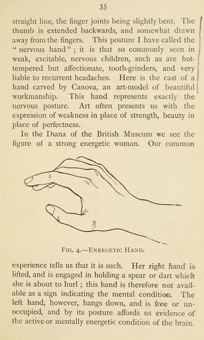 straight line, the finger joints being slightly bent. The 1 thumb is extended backwards, and somewhat drawn j away from the fingers. This posture I have called the i “nervous hand’’; it is that so commonly seen in ! weak, excitable, nervous children, such as are hot- j tempered but affectionate, tooth-grinders, and very 1 liable to recurrent headaches. Here is the cast of a | hand carved by Canova. an art-model of beautiful workmanship. This hand represents exactly the nervous posture. Art often presents us with the expression of weakness in place of strength, beauty in place of perfectness. In the Diana of the British Museum we see the figure of a strong energetic woman. Our common experience tells us that it is such. Her right hand is; lifted, and is engaged in holding a spear or dart which she is about to hurl; this hand is therefore not avail- able as a sign indicating the mental condition. The left hand, however, hangs down, and is free or un- occupied, and by its posture affords us evidence of the active or mentally energetic condition of the braim