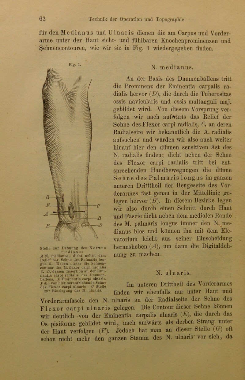 für den Medianus und Ulnaris dienen die am Carpus und Vorder- arme unter der Haut sicht- und fühlbaren Knochenprominenzen und Sehnencontouren, wie wir sie in Fig. 1 wiedergegeben finden. Fig. 1. Stelle zur Dehnung des Nervus ruedianus. A N. medianus, dicht neben dem Relief der Sehne des Palmaris lon- gus B. Neben dieser die Sehnen- contour des M. flexor carpi radialis C. B, dessen Insertion an der Emi- nentia earpi radialis des Daumen- ballens. E Eminentia carpi ulnaris. F die von hier heraufziehende Sehne des Flexor carpi ulnaris G Stelle zur Bioslegung des N. ulnaris. N. medianus. An der Basis des Daumenballens tritt die Prominenz der Eminentia carpalis ra- dialis hervor (D), die durch die Tuberositas ossis navicularis und ossis multanguli maj. gebildet wird. Von diesem Vorsprung ver- folgen wir nach aufwärts das Relief der Sehne des Flexor carpi radialis, C, an deren Radialseite wir bekanntlich die A. radialis aufsuchen und würden wir also auch weiter hinauf hier den dünnen sensitiven Ast des N. radialis finden; dicht neben der Sehne des Flexor carpi radialis tritt bei ent- sprechenden Handbewegungen die dünne Sehne desPalmarislongus im ganzen unteren Dritttheil der Beugeseite des Vor- derarmes fast genau in der Mittellinie ge- legen hervor (B). In diesem Bezirke legen wir also durch einen Schnitt durch Haut und Fascie dicht neben dem medialen Rande des M. palmaris longus immer den K.^me- dianus blos und können ihn mit dem Ele- vatorium leicht aus seiner Einscheidung herausheben (A), um dann die Digitaldeh- nung zu machen. N. ulnaris. Im unteren Drittheil des Vorderarmes finden wir ebenfalls nur unter Haut und Vorderarmfascie den N. ulnaris an der Radialseite der Sehne des Flexor carpi ulnaris gelegen. Die Contour dieser Sehne können wir deutlich von der Eminentia carpalis ulnaris (E), die durch das Os pisiforme gebildet wird, nach aufwärts als derben Strang unter der Haut verfolgen (<F). Jedoch hat man an dieser Stelle (O) oft schon nicht mehr den ganzen Stamm des N. ulnaris- vor sich, da I