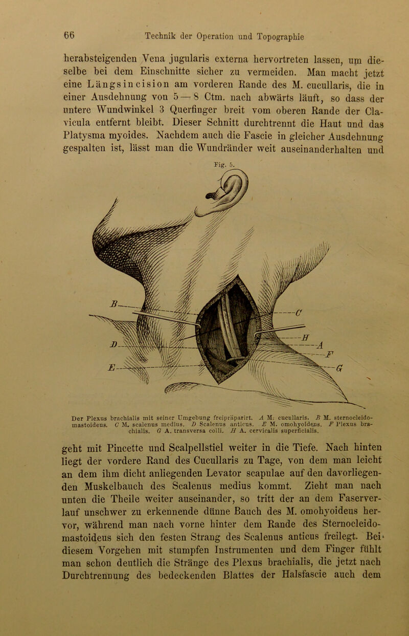 herabsteigenden Vena jugularis externa hervortreten lassen, um die- selbe bei dem Einschnitte sicher zu vermeiden. Man macht jetzt eine Längsincision am vorderen Hände des M. cucullaris, die in einer Ausdehnung von 5—8 Ctm. nach abwärts läuft, so dass der untere Wundwinkel 3 Querfinger breit vom oberen Rande der Cla- vicula entfernt bleibt. Dieser Schnitt durchtrennt die Haut und das Platysma myoides. Nachdem auch die Fascie in gleicher Ausdehnung gespalten ist, lässt man die Wundränder weit auseinanderhalten und Fig. 5. Der Plexus brnehialis mit seiner Umgebung freipräparirt. A M; cucullaris. B M. sternocleido- mastoideus. C M. scalenus medius. D Scalenus anticus. E M. omohyoideus. F Plexus bra- chialis. G A. transversa colli. H A. cervicalis superficialis. geht mit Pincette und Scalpellstiel weiter in die Tiefe. Nach hinten liegt der vordere Rand des Cucullaris zu Tage, von dem man leicht an dem ihm dicht anliegenden Levator scapulae auf den davorliegen- den Muskelbauch des Scalenus medius kommt. Zieht man nach unten die Theile weiter auseinander, so tritt der an dem Faserver- lauf unschwer zu erkennende dünne Bauch des M. omohyoideus her- vor, während man nach vorne hinter dem Rande des Sternocleido- mastoideus sich den festen Strang des Scalenus anticus freilegt. Bei* diesem Vorgehen mit stumpfen Instrumenten und dem Finger fühlt man schon deutlich die Stränge des Plexus brachialis, die jetzt nach Durchtrennung des bedeckenden Blattes der Halsfascie auch dem