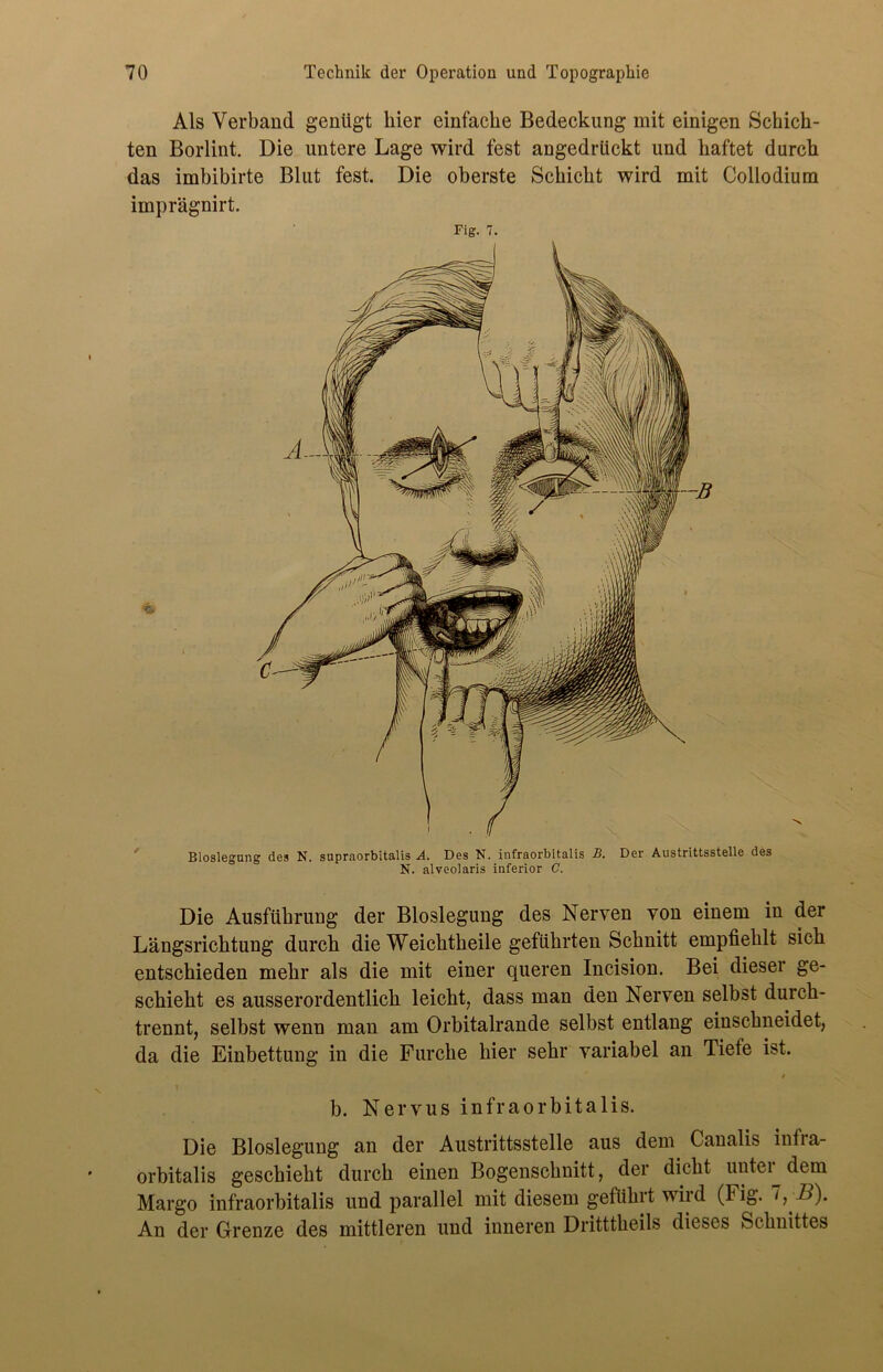 Als Verband genügt hier einfache Bedeckung mit einigen Schich- ten Borlint. Die untere Lage wird fest angedrückt und haftet durch das imbibirte Blut fest. Die oberste Schicht wird mit Collodium imprägnirt. Fig. 7. Bioslegung des N. supraorbitalis A. Des N. infraorbitalis B. Der Austrittsstelle des N. alveolaris inferior C. Die Ausführung der Bloslegung des Nerven von einem in der Längsrichtung durch die Weichtheile geführten Schnitt empfiehlt sich entschieden mehr als die mit einer queren Incision. Bei dieser ge- schieht es ausserordentlich leicht? dass man den Nerven selbst durch- trennt, selbst wenn man am Orbitalrande selbst entlang einschneidet, da die Einbettung in die Furche hier sehr variabel an Tiefe ist. t \ b. Nervus infraorbitalis. Die Bloslegung an der Austrittsstelle aus dem Canalis infia- orbitalis geschieht durch einen Bogenschnitt, der dicht unter dem Margo infraorbitalis und parallel mit diesem geführt wird (Fig. 1 ,B). An der Grenze des mittleren und inneren Dritttheils dieses Schnittes