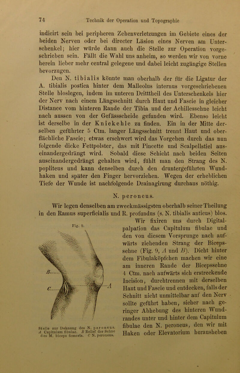 indicirt sein bei peripheren Zehenverletzungen im Gebiete eines der beiden Nerven oder bei directer Läsion eines Nerven am Unter- schenkel; hier würde dann auch die Stelle zur Operation vorge- scbrieben sein. Fällt die Wahl uns anheim, so werden wir von vorne herein lieber mehr central gelegene und dabei leicht zugängige Stellen bevorzugen. Den N. tibialis könnte man oberhalb der für die Ligatur der A. tibialis postica hinter dem Malleolus internus vorgeschriebenen Stelle bloslegen, indem im unteren Dritttheil des Unterschenkels hier der Nerv nach einem Längsschnitt durch Haut und Fascie in gleicher Distance vom hinteren Rande der Tibia und der Achillessehne leicht nach aussen von der Gefässscheide gefunden wird. Ebenso leicht ist derselbe in der Kniekehle zu finden. Ein in der Mitte der- selben geführter 5 Ctm. langer Längsschnitt trennt Haut und ober- flächliche Fascie; etwas erschwert wird das Vorgehen durch das nun folgende dicke Fettpolster, das mit Pincette und Scalpellstiel aus- einandergedrängt wird. Sobald diese Schicht nach beiden Seiten auseinandergedrängt gehalten wird, fühlt man den Strang des N. popliteus und kann denselben durch den druntergeführten Wund- haken und später den Finger hervorziehen. Wegen der erheblichen Tiefe der Wunde ist nachfolgende Drainagirung durchaus nöthig. N. peroneus. Wir legen denselben am zweckmässigsten oberhalb seiner Theilung in den Ramus superficialis und R. profundus (s. N. tibialis anticus) blos. Wir fixiren uns durch Digital- palpation das Capitulum fibulae und den von diesem Vorsprunge nach auf- wärts ziehenden Strang der Biceps- sehne (Fig. 9, A und B). Dicht hinter dem Fibulaköpfchen machen wir eine am inneren Rande der Bicepssehne 4 Ctm. nach aufwärts sich erstreckende Incision, durchtrennen mit derselben Haut und Fascie und entdecken, falls der Schnitt nicht unmittelbar auf den Nerv sollte geführt haben, sicher nach ge- ringer Abhebung des hinteren Wund- randes unter und hinter dem Capitulum »eile *„r Dehn««» de. n. peroneus, fibulae den N. peroneus, den wir mit Haken oder Elevatorimn herausheben