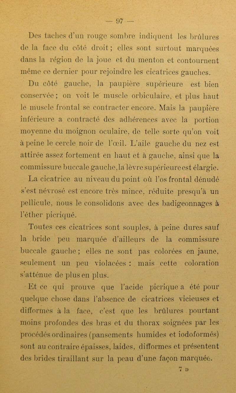 Des taches d’un rouge sombre indiquent les brûlures delà face du côté droit; elles sont surtout marquées dans la région de la joue et du menton et contournent même ce dernier pour rejoindre les cicatrices gauches. Du côté gauche, la paupière supérieure est bien conservée ; on voit le muscle orbiculaire, et plus haut le muscle frontal se contracter encore. Mais la paupière inférieure a contracté des adhérences avec la portion moyenne du moignon oculaire, de telle sorte qu’on voit à peine le cercle noir de l’œil. L’aile gauche du nez est attirée assez fortement en haut et à gauche, ainsi que la commissure buccale gauche,la lèvre supérieure est élargie. La cicatrice au niveau du point où l’os frontal dénudé s’est névrosé est encore très mince, réduite presqu’à un pellicule, nous le consolidons avec des badigeonnages à l’éther picriqué. Toutes ces cicatrices sont souples, à peine dures sauf la bride peu marquée d’ailleurs de la commissure buccale gauche ; elles ne sont pas colorées en jaune, seulement un peu violacées : mais cette coloration s’atténue de plus en plus. Et ce qui prouve que l’acide picriqué a été pour quelque chose dans l’absence de cicatrices vicieuses et difformes à la face, c’est que les brûlures pourtant moins profondes des bras et du thorax soignées par les procédés ordinaires (pansements humides et iodoformés) sont au contraire épaisses, laides, difformes et présentent des brides tiraillant sur la peau d’une façon marquée. 7 i)