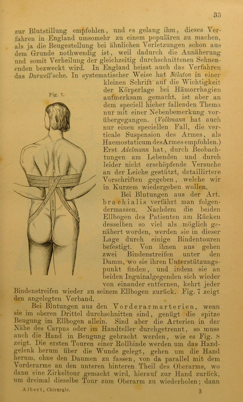 zur Blutstillung empfohlen, und es gelang ihm, dieses Ver- fahren in England umsomehr zu einem populären zu machen, als ja die Beugestellung bei ähnlichen Verletzungen schon aus dem Grunde nothwendig ist, weil dadurch die Annäherung und somit Verheilung der gleichzeitig durchschnittenen Sehnen- enden bezweckt wird. In England heisst auch das Verfahren das DurwelVsehe. In systematischer Weise hat Nelaton in einer kleinen Schrift auf die Wichtigkeit der Körperlage bei Hämorrhagien aufmerksam gemacht, ist aber an dem speciell hieher fallenden Thema nur mit einer Nebenbemerkung vor- übergegangen. (Volkmann hat auch nur einen speciellen Fall, die ver- ticale Suspension des Armes, als Haemostaticum des Armes empfohlen.) Erst Adelmann hat, durch Beobach- tungen am Lebenden und durch leider nicht erschöpfende Versuche an der Leiche gestützt, detaillirtere Vorschriften gegeben, welche wir in Kurzem wiedergeben wollen. Bei Blutungen aus der Art. brachialis verfährt man folgen- dermassen. Nachdem die beiden Ellbogen des Patienten am Kücken desselben so viel als möglich ge- nähert worden, werden sie in dieser Lage durch einige Bindentouren befestigt. Von ihnen aus gehen zwei Bindenstreifen unter den Damm, wo sie ihren Unterstützungs- punkt finden, und indem sie an beiden Inguinalgegenden sich wieder von einander entfernen, kehrt jeder Bindenstreifen wieder zu seinem Ellbogen zurück. Fig. 7 zeigt den angelegten Verband. Bei Blutungen aus den Vorderarmarterien, wenn sie im oberen Drittel durchschnitten sind, genügt die spitze Beugung im Ellbogen allein. Sind aber die Arterien in der Nähe des Carpus oder im Handteller durchgetrennt, so muss auch die Hand in Beugung gebracht werden , wie es Fig. !S zeigt. Die ersten Touren einer Rollbinde werden um das Hand- gelenk herum über die Wunde gelegt, gehen um die Hand herum, ohne den Daumen zu fassen, von da parallel mit dem Vorderarme an den unteren hinteren Theil des Oberarms, wo dann eine Zirkeltour gemacht wird, hierauf zur Hand zurück, um dreimal dieselbe Tour zum Oberarm zu wiederholen; dann AIbert, Chirurgie. o