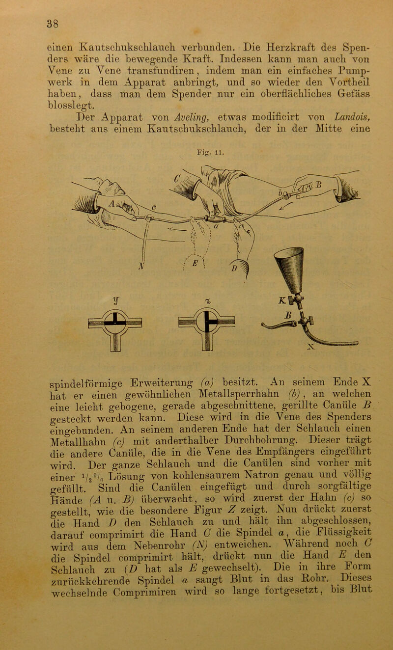 einen Kautschukschlauch verbunden. Die Herzkraft des Spen- ders wäre die bewegende Kraft. Indessen kann man auch von Vene zu Vene tränsfundiren, indem man ein einfaches Pump- werk in dem Apparat anbringt, und so wieder den Vortheil haben, dass man dem Spender nur ein oberflächliches Gefäss blosslegt. Der Apparat von Aveling, etwas modificirt von Landois, besteht aus einem Kautschukschlauch, der in der Mitte eine Fig- 11. spindelförmige Erweiterung (a) besitzt. An seinem Ende X hat er einen gewöhnlichen Metallsperrhahn (b), an welchen eine leicht gebogene, gerade abgeschnittene, gerillte Canäle B gesteckt werden kann. Diese wird in die Vene des Spenders eingebunden. An seinem anderen Ende hat der Schlauch einen Metallhahn (c) mit anderthalber Durchbohrung. Dieser trägt die andere Canäle, die in die Vene des Empfängers eingefährt wird. Der ganze Schlauch und die Canälen sind vorher mit einer 1/20/n Lösung von kohlensaurem Natron genau und völlig gefällt. Sind die Canälen eingefägt und durch sorgfältige Hände (A u. B) überwacht, so wird zuerst der Hahn (c) so gestellt, wie die besondere Eigur Z zeigt. Nun drückt zuerst die Hand D den Schlauch zu und hält ihn abgeschlossen, darauf comprimirt die Hand C die Spindel a, die Elässigkeit wird aus dem Nebenrohr (N) entweichen. Während noch C die Spindel comprimirt hält, drückt nun die Hand E den Schlauch zu (D hat als E gewechselt). Die in ihre Form zuräckkehrende Spindel a saugt Blut in das Kohr. Dieses wechselnde Comprimiren wird so lange fortgesetzt, bis Blut