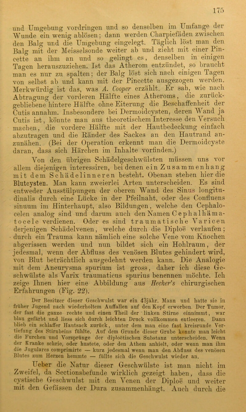 und Umgebung Vordringen und so denselben im Umfange der Wunde ein wenig ablösen; dann werden Charpiefäden zwischen den Balg und die Umgebung eingelegt. Täglich löst man den Balg mit der Meisseisonde weiter ab und zieht mit einer Pin- cette an ihm an und so gelingt es, denselben in einigen Tagen herauszuziehen. Ist das Atherom entzündet, so braucht man es nur zu spalten; der Balg löst sich nach einigen Tagen von selbst ab und kann mit der Pincette ausgezogen werden. Merkwürdig ist das, was A. Cooper erzählt. Er sah,. wie nach Abtragung der vorderen Hälfte eines Atheroms, die zurück- gebliebene hintere Hälfte ohne Eiterung die Beschaffenheit der Cutis annahm. Insbesondere bei Dermoidcysten, deren Wand ja Cutis ist, könnte man aus theoretischem Interesse denVersuch machen, die vordere Hälfte mit der Hautbedeckung einfach abzutragen und die Ränder des Sackes an den Hautrand an- zunähen. (Bei der Operation erkennt man die Dermoidcyste daran, dass sich Härchen im Inhalte vorfinden.) Von den übrigen Schädelgeschwülsten müssen uns vor allem diejenigen interessiren, bei denen ein Zusammenhang mit dem Schädelinneren besteht. Obenan stehen hier die Blutcysten. Man kann zweierlei Arten unterscheiden. Es sind entweder Ausstülpungen der oberen Wand des Sinus longitu- dinalis durch eine Lücke in der Pfeilnaht, oder des Confluens sinuum im Hinterhaupt, also Bildungen, welche den Cephalo- celen analog sind und darum auch den Namen Cephalhäma- tocele verdienen. Oder es sind traumatische Varicen derjenigen Schädelvenen, welche durch die Diploe verlaufen; durch ein Trauma kann nämlich eine solche Vene vom Knochen abgerissen werden und nun bildet sich ein Hohlraum, der jedesmal, wenn der Abfluss des venösen Blutes gehindert wird, von Blut beträchtlich ausgedehnt werden kann. Die Analogie mit dem Aneurysma spurium ist gross, daher ich diese Ge- schwülste als Yarix traumaticus spurius benennen möchte. Ich zeige Ihnen hier eine Abbildung aus Hecker’s chirurgischen Erfahrungen (Fig. 22). Der Besitzer dieser Geschwulst war ein 43jälir. Mann und hatte sie in früher Jugend nach wiederholtem Auffallen auf den Kopf erworben. Der Tumor, der fast die ganze rechte und einen Theil der linken Stirne einnimmt, war blau gefärbt und liess sich durch leichten Druck vollkommen entleeren. Dann blieb ein schlaffer Hautsack zurück, unter dem man eine fast kreisrunde Ver- tiefung des Stirnbeins fühlte. Auf dem Grunde dieser Grube konnte man leicht die Furchen und Vorsprünge der diploetischen Substanz unterscheiden. Wenn der Kranke schrie, oder hustete, oder den Athem anhielt, oder wenn man ihm die .Tugulares comprimirte — kurz jedesmal wenn man den Abfluss des venösen Blntes zum Herzen hemmte — füllte sich die Geschwulst wieder an. lieber die Natur dieser Geschwülste ist man nicht im Zweifel, da Sectionsbefunde wirklich gezeigt haben, dass die cystische Geschwulst mit den Venen der Diploe und weiter mit den Gefässen der Dura zusammenhängt. Auch durch die